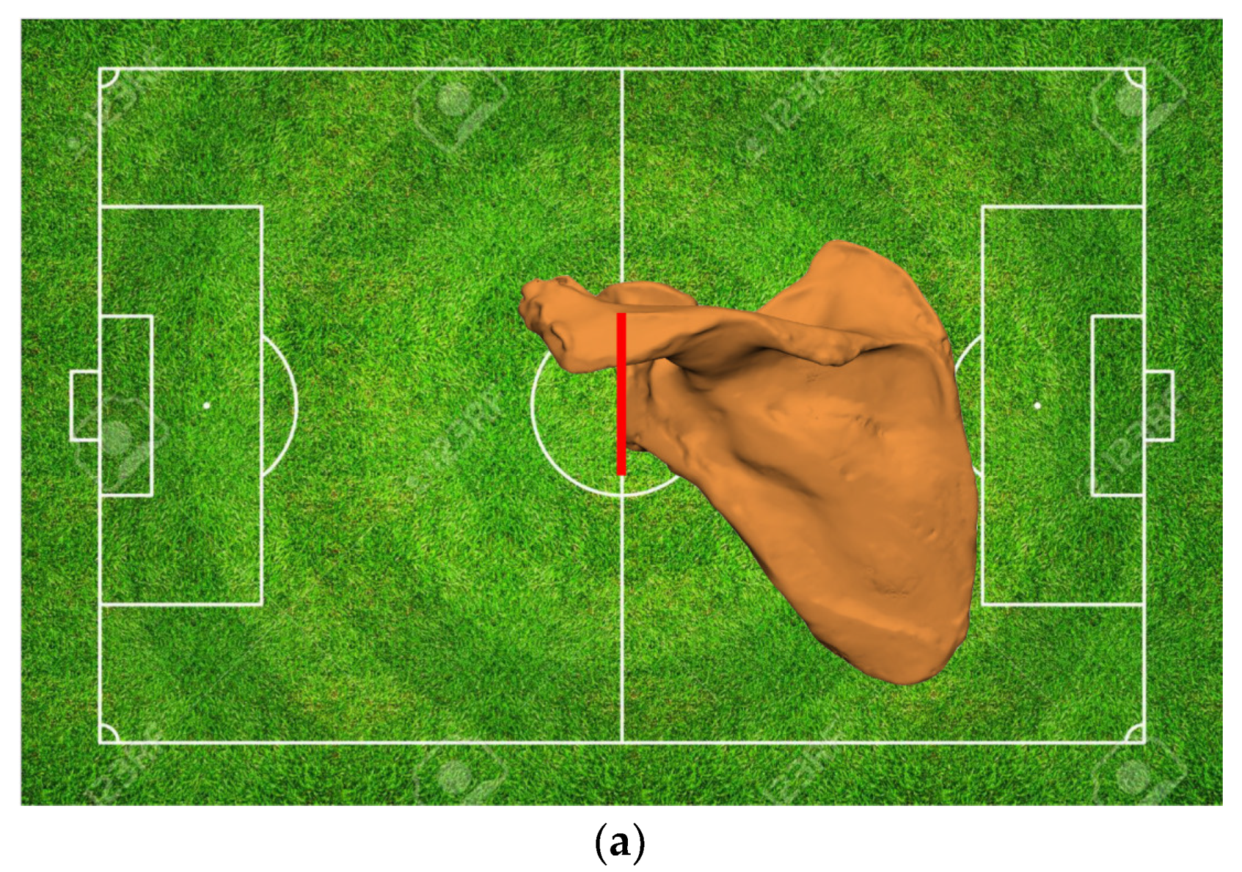 Jcm 11 07422 g004a Jcm 11 07422 g004a