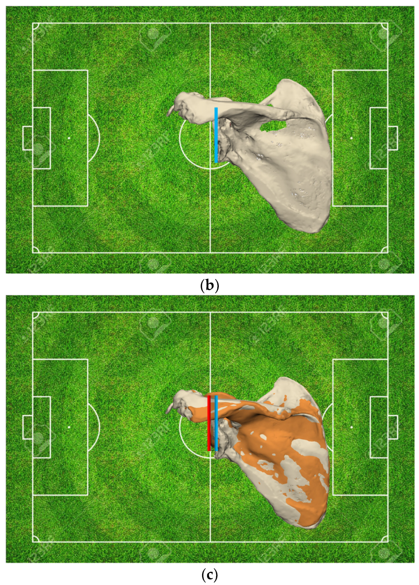 Jcm 11 07422 g004b Jcm 11 07422 g004b