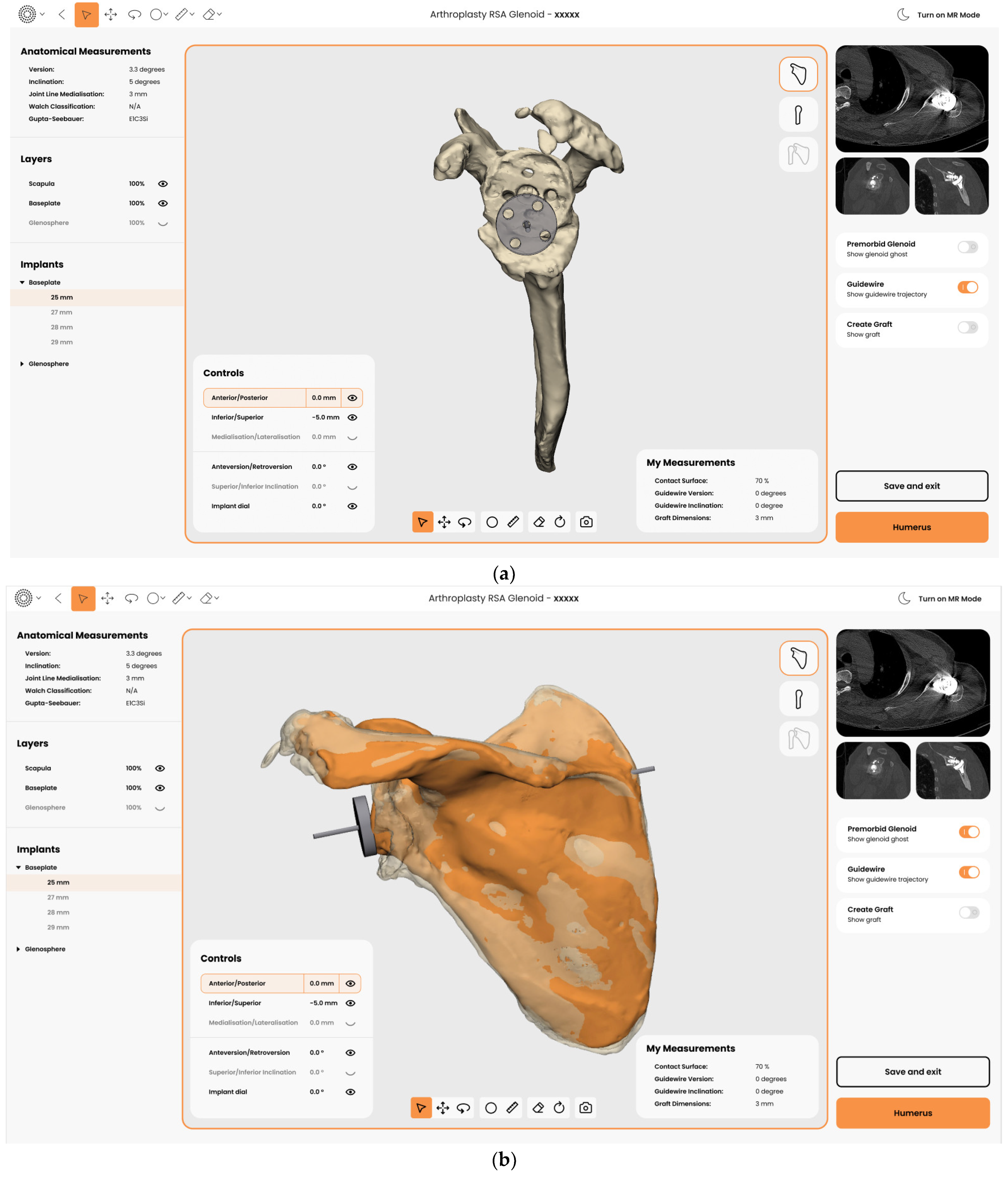 Jcm 11 07422 g006 Jcm 11 07422 g006