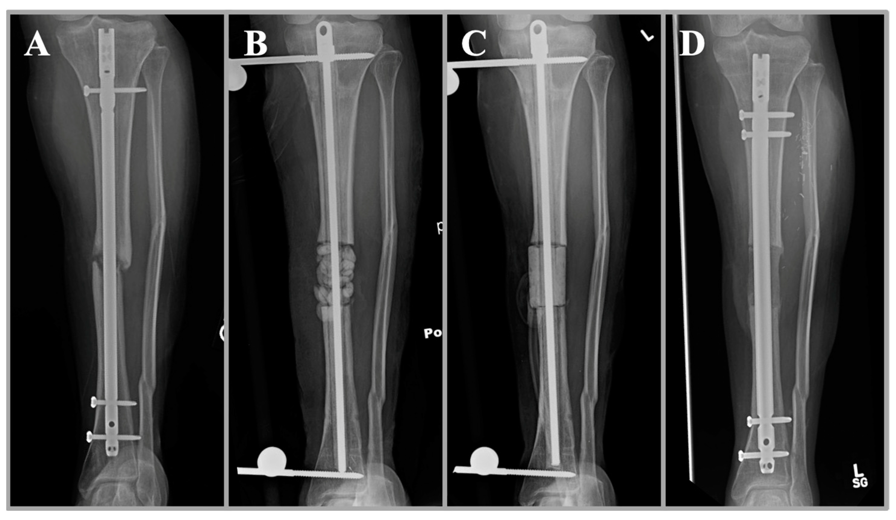 Jcm 11 07461 g003 Jcm 11 07461 g003