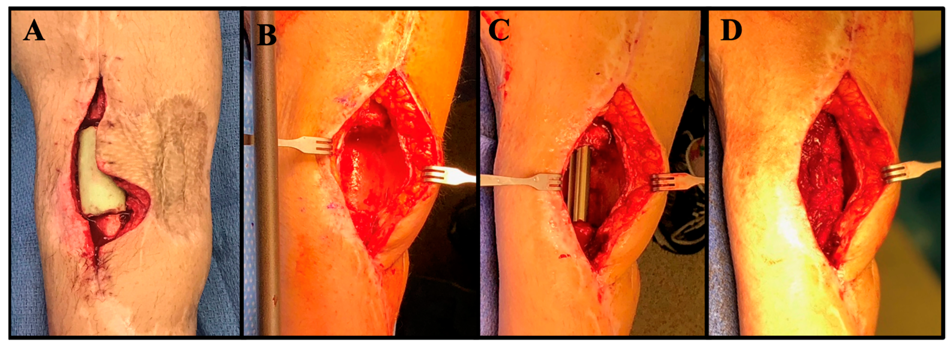 Jcm 11 07461 g004 Jcm 11 07461 g004