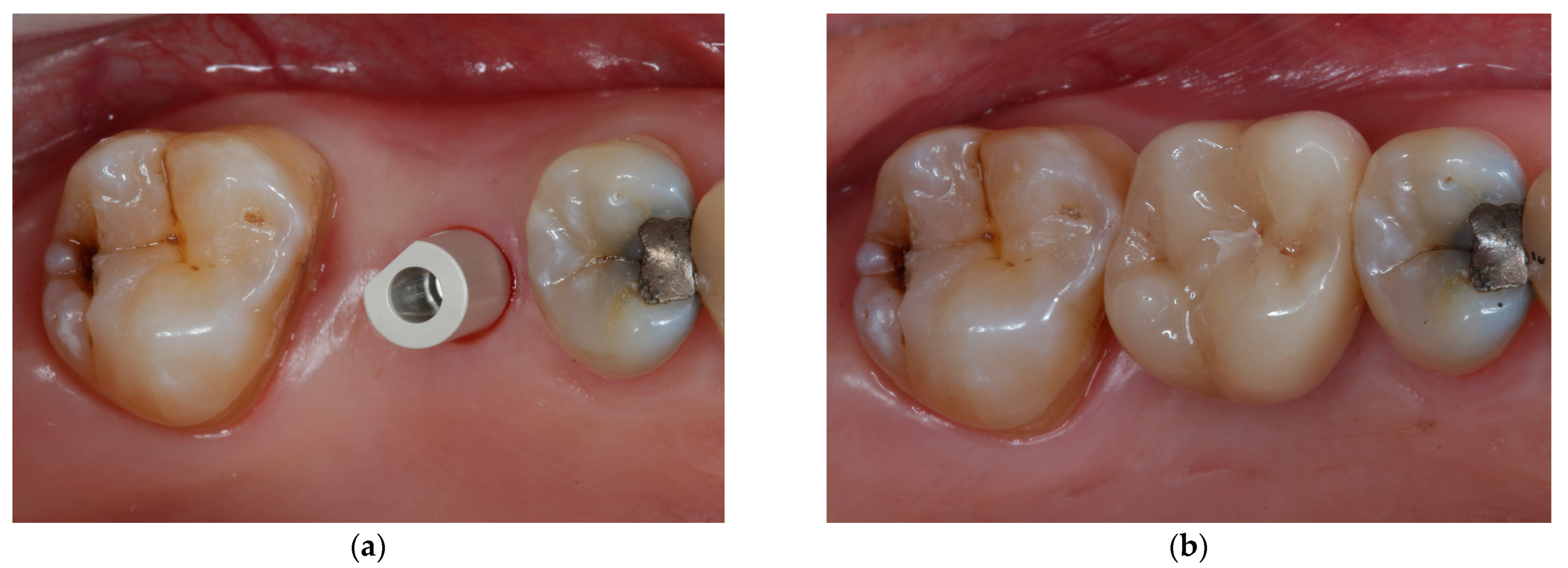 Jcm 11 07496 g003 Jcm 11 07496 g003
