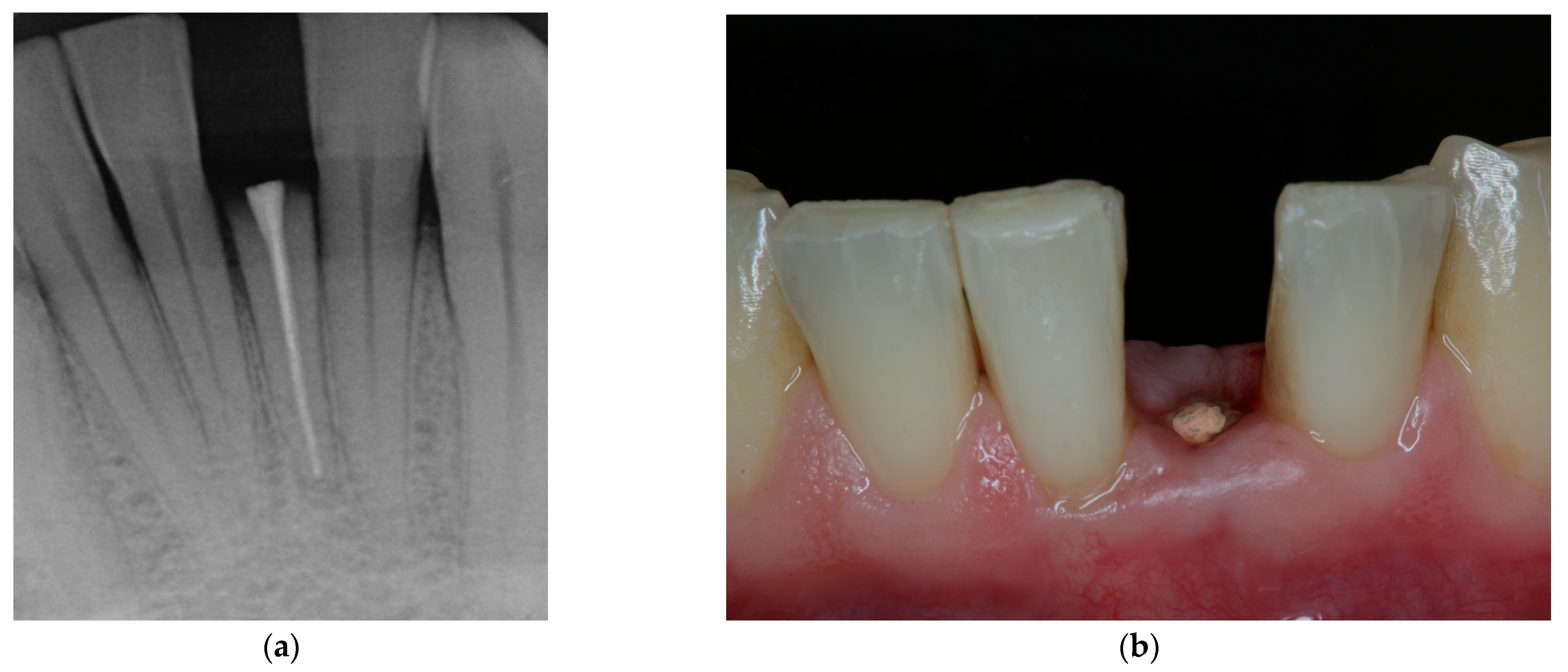 Jcm 11 07496 g005 Jcm 11 07496 g005