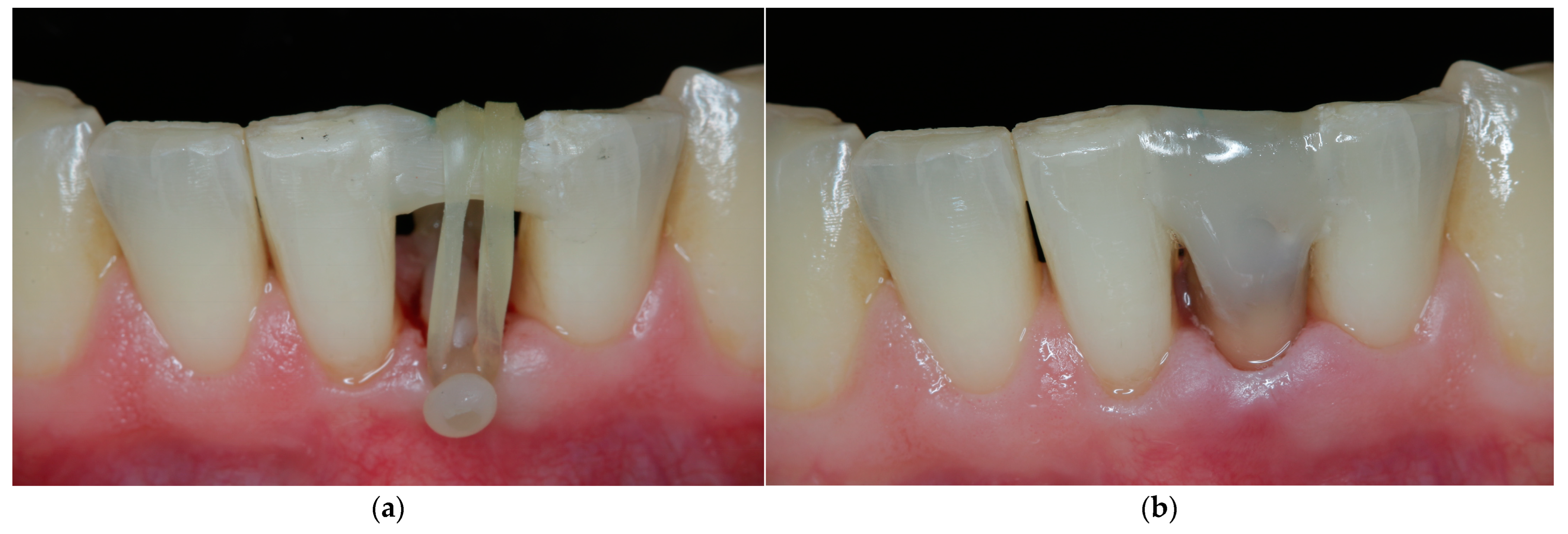 Jcm 11 07496 g006 Jcm 11 07496 g006