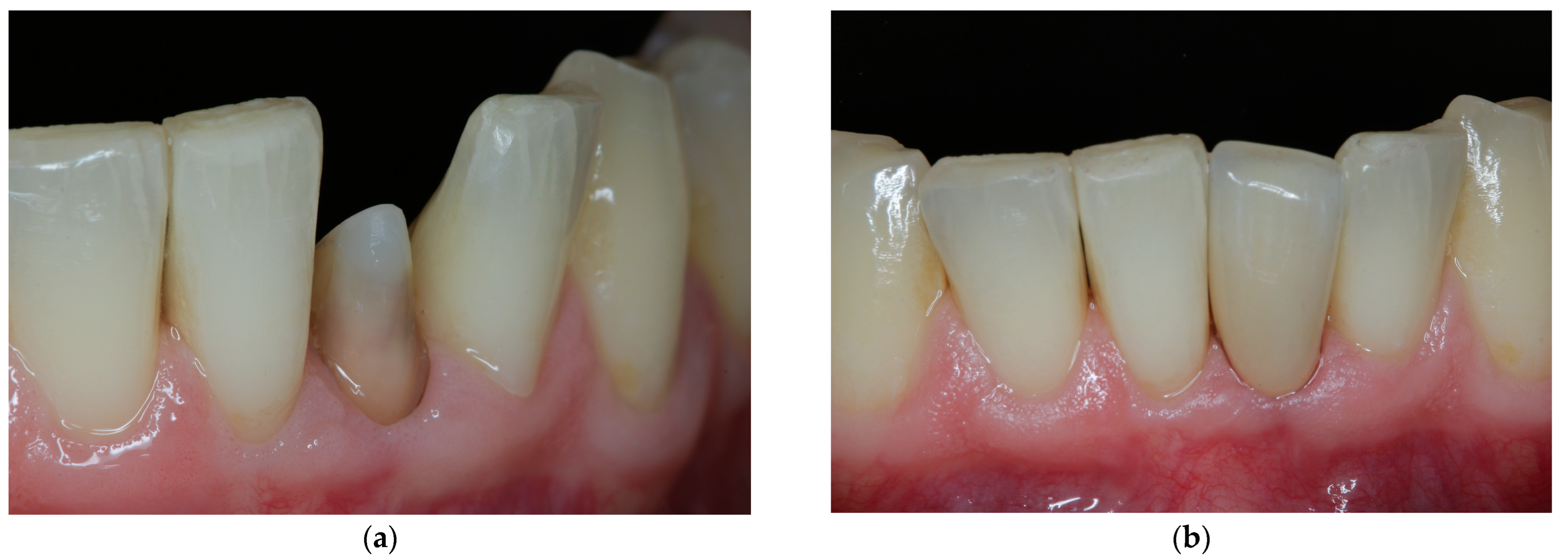 Jcm 11 07496 g007 Jcm 11 07496 g007