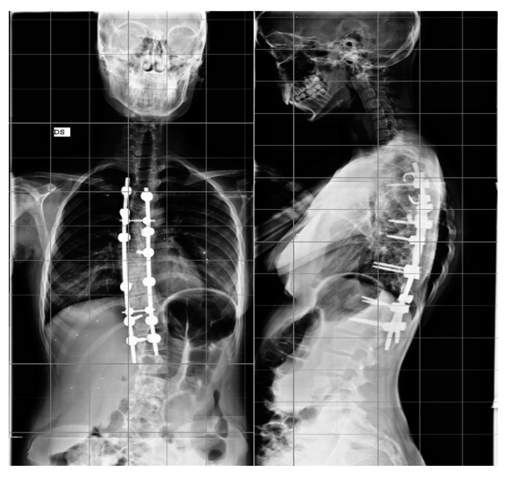 Jcm 12 00076 g002 Jcm 12 00076 g002