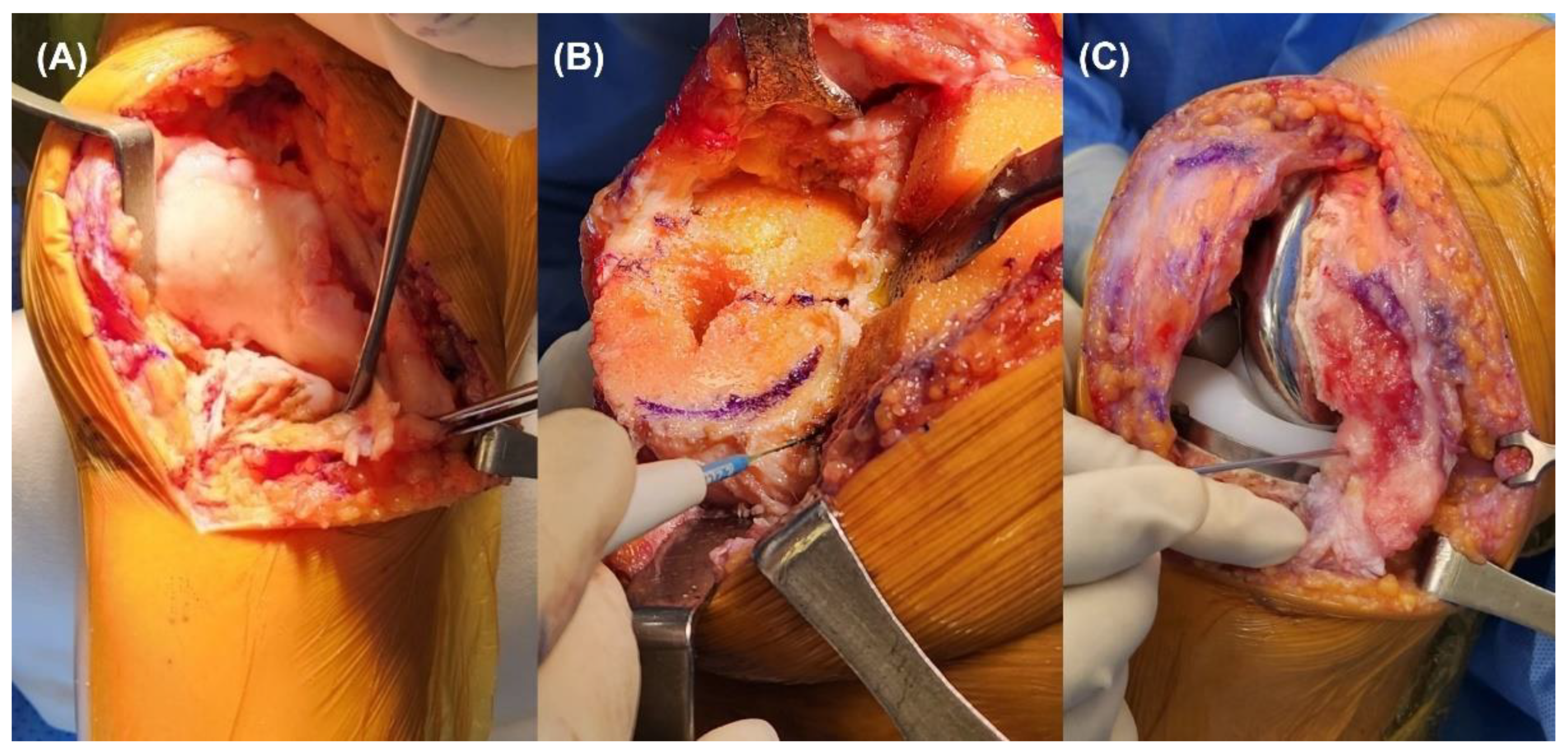 Jcm 12 00263 g001 Jcm 12 00263 g001