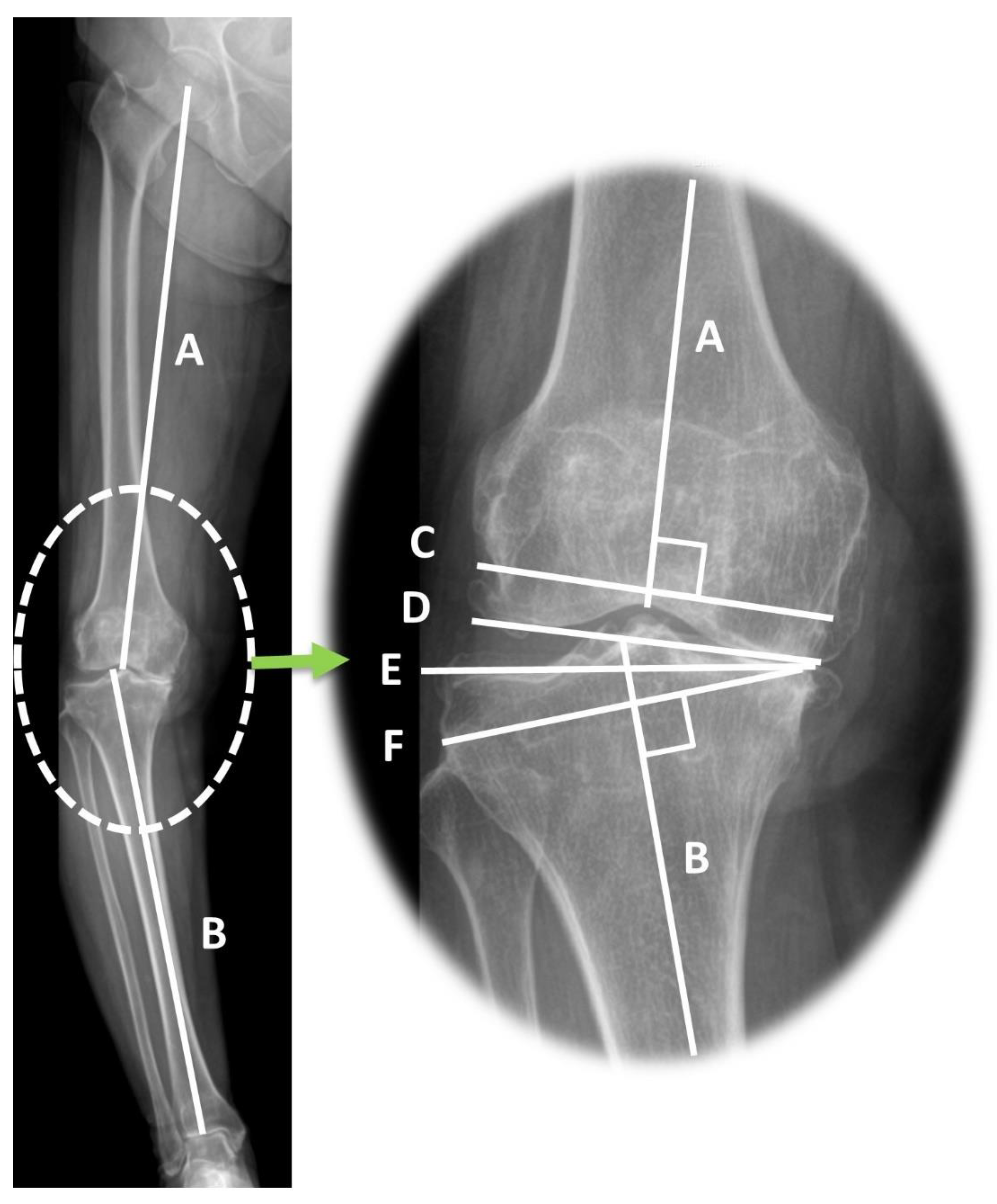 Jcm 12 00263 g003 Jcm 12 00263 g003