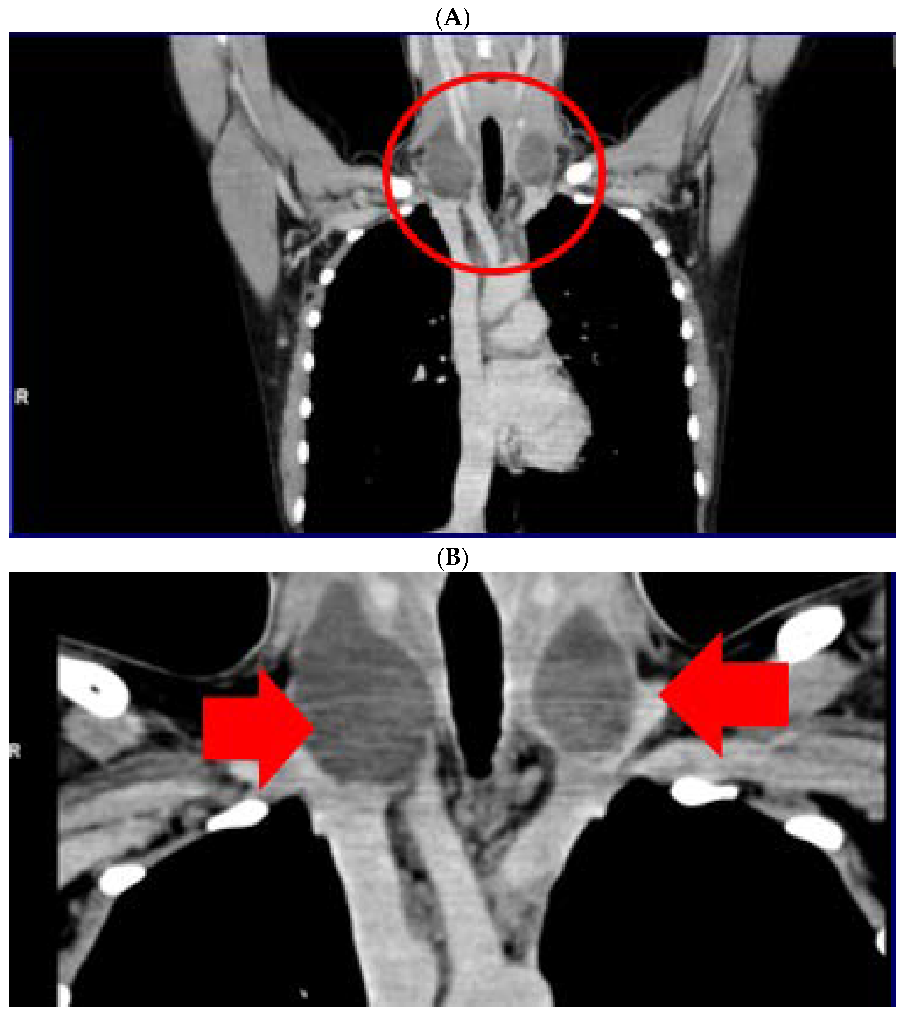 Jcm 12 00474 g003a Jcm 12 00474 g003a