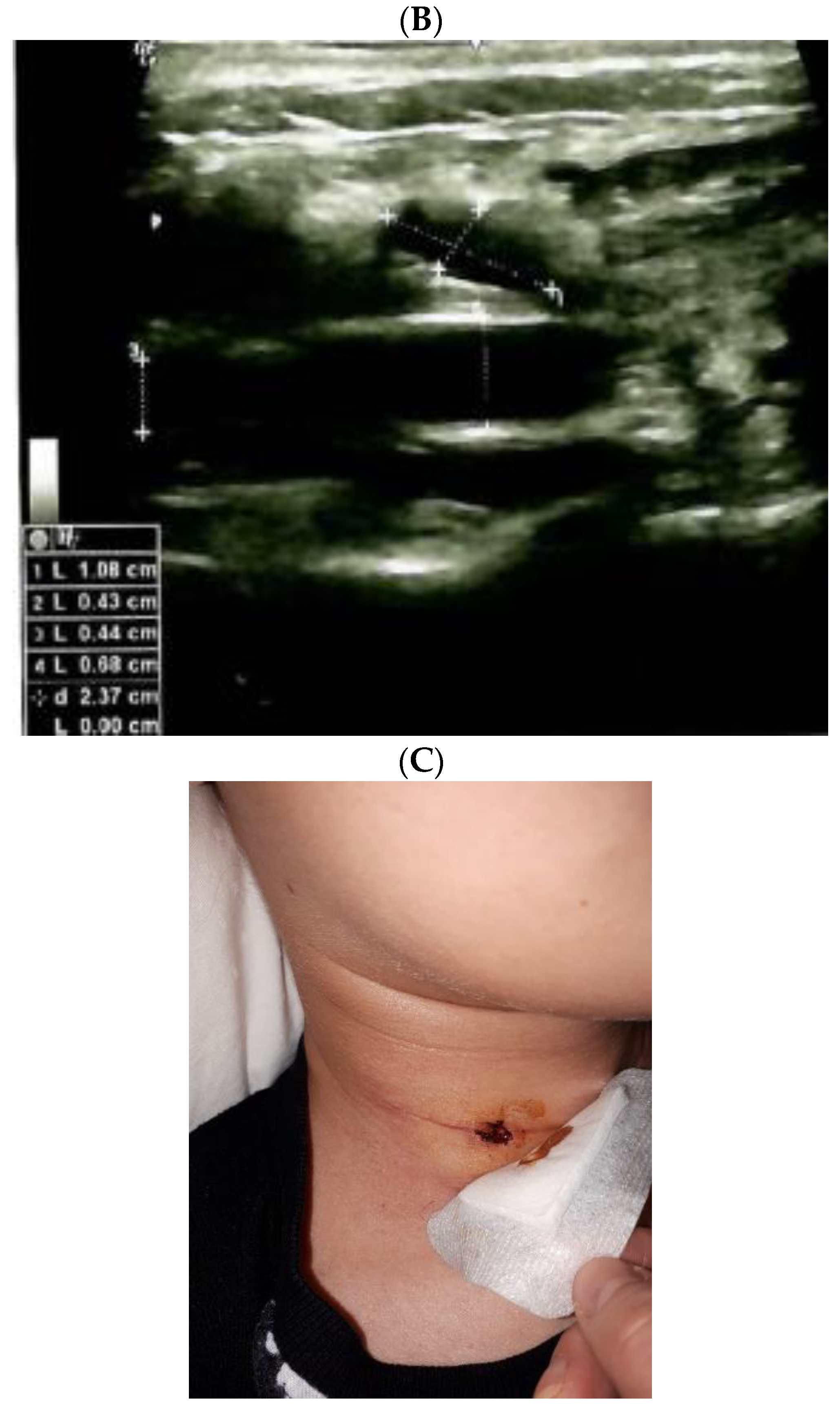 Jcm 12 00474 g004b Jcm 12 00474 g004b