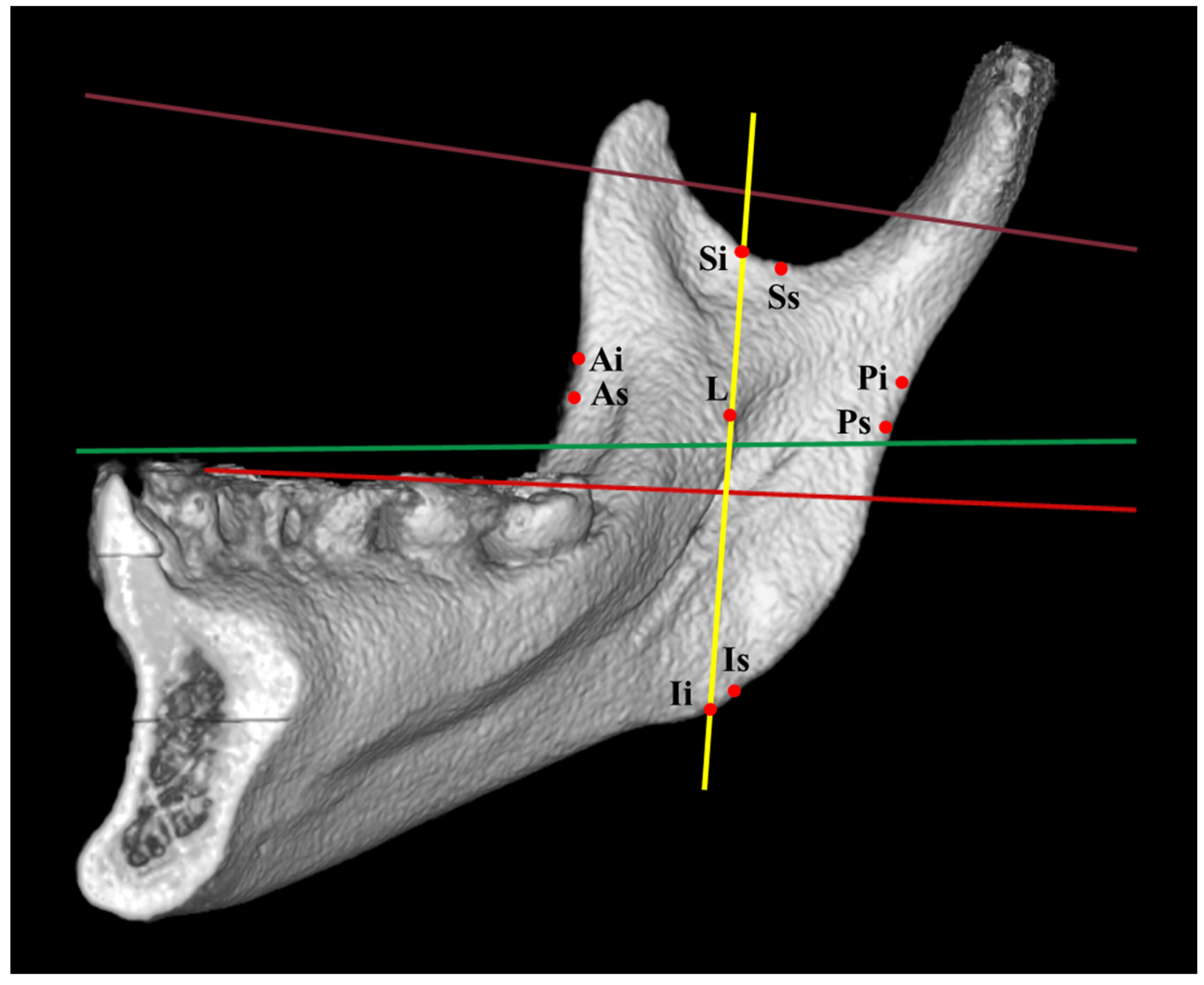 Jcm 12 00881 g002 Jcm 12 00881 g002