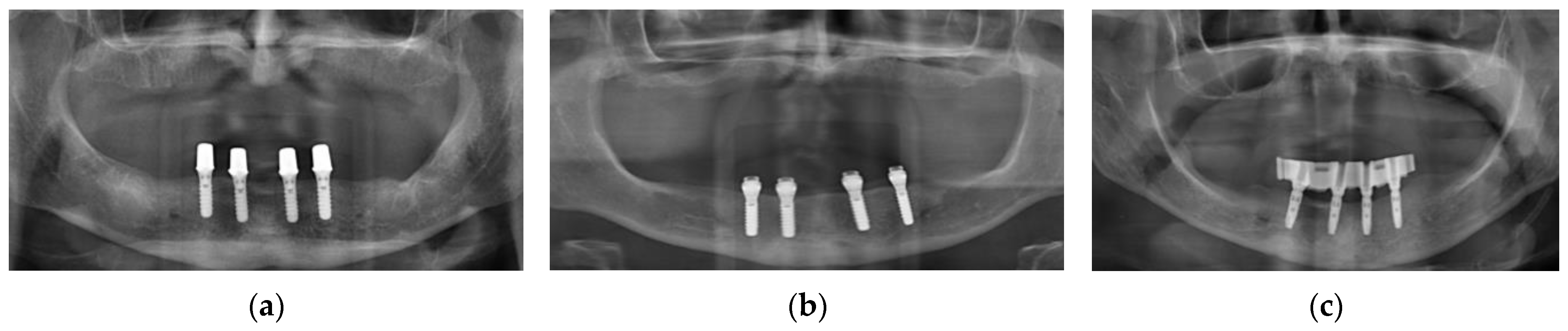 Jcm 12 01012 g002 Jcm 12 01012 g002