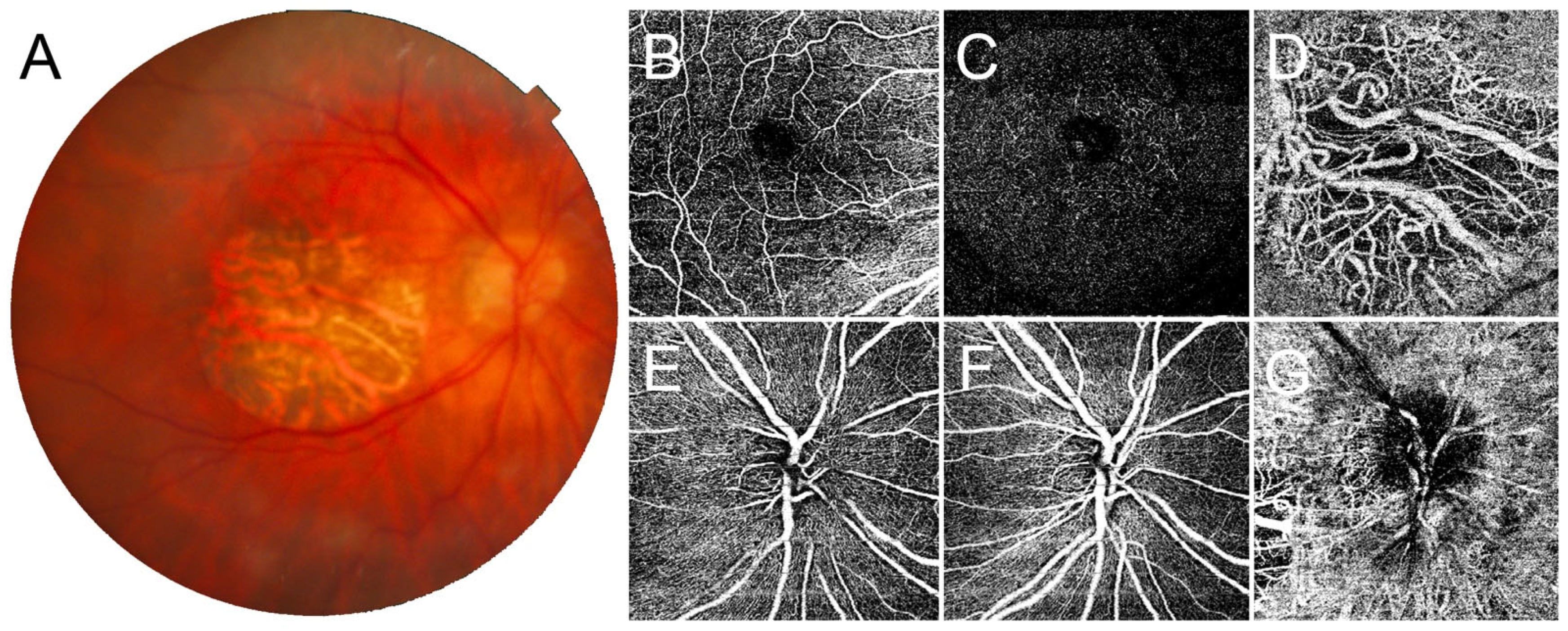 Jcm 12 01095 g001 Jcm 12 01095 g001