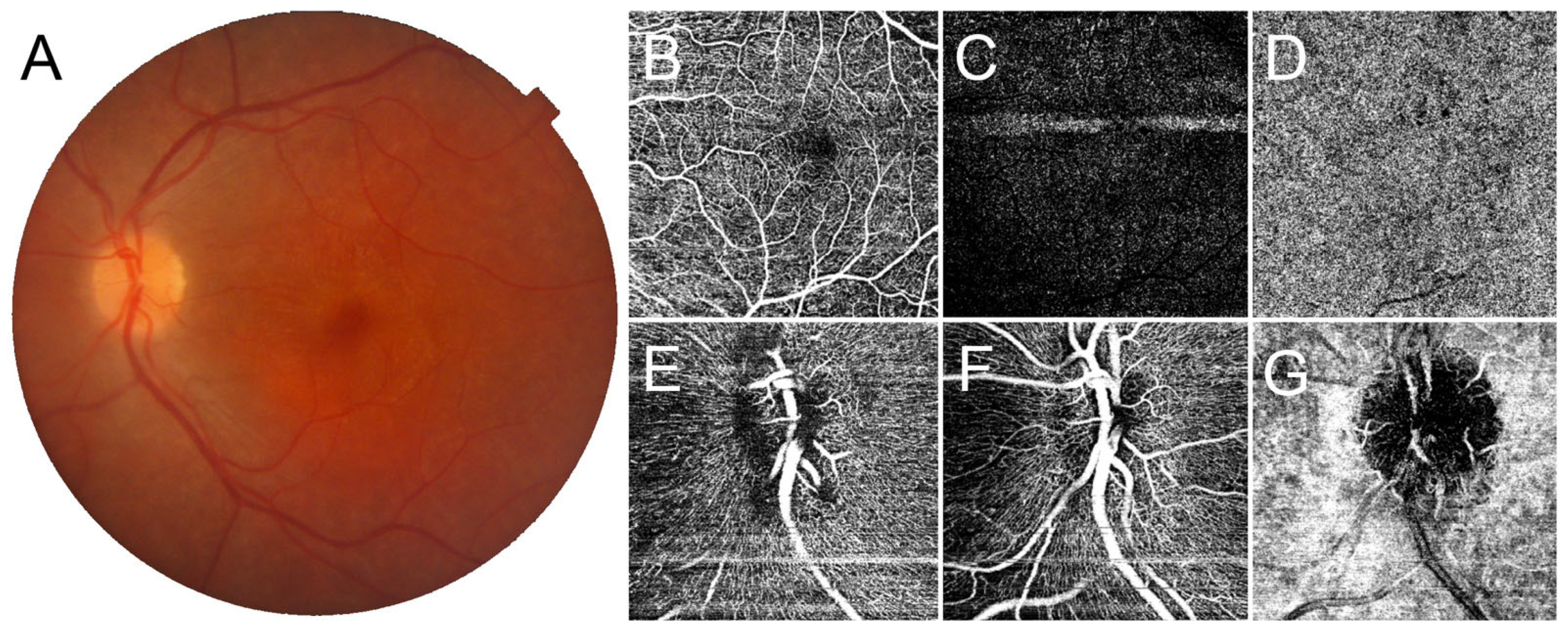 Jcm 12 01095 g002 Jcm 12 01095 g002