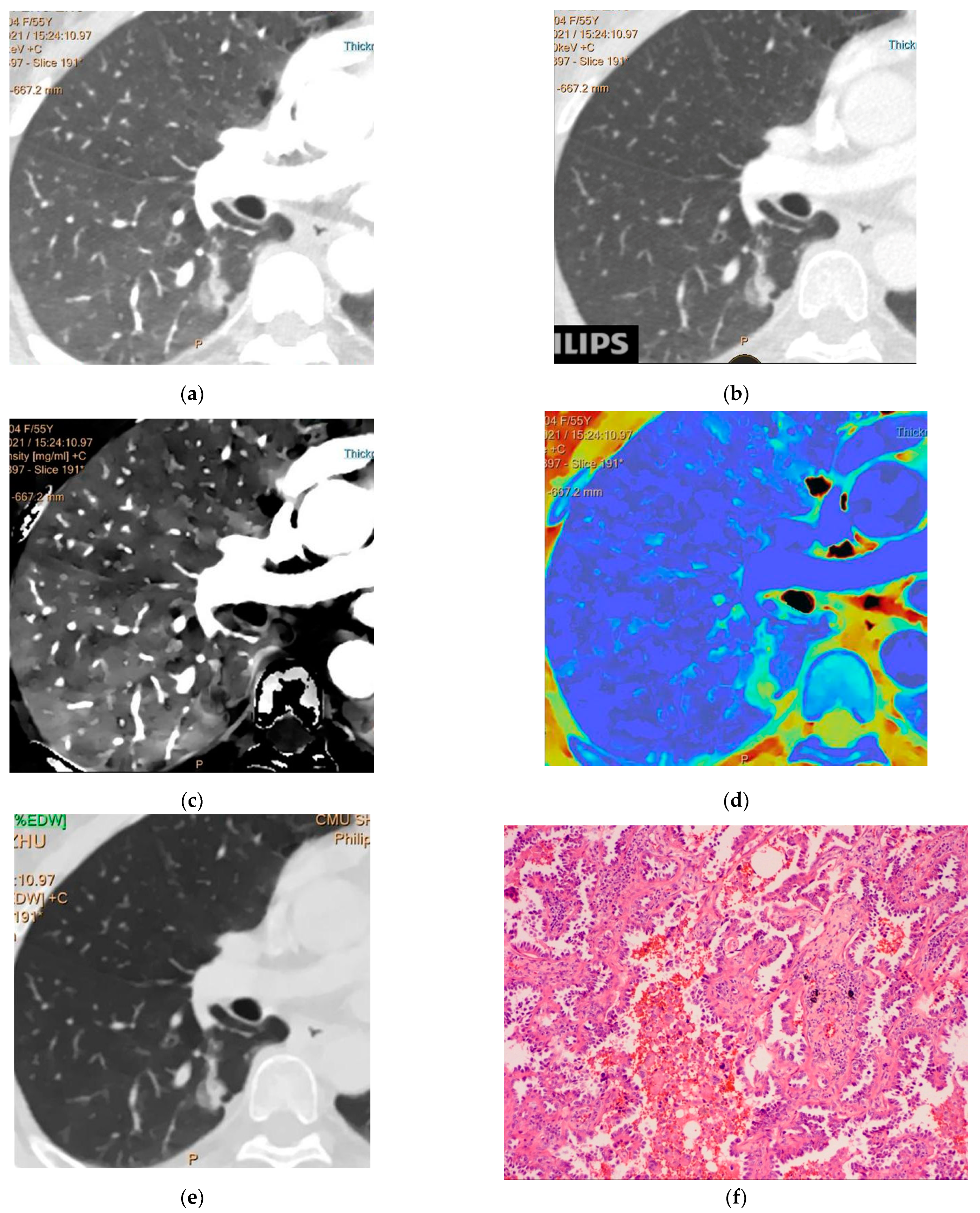 Jcm 12 01107 g003 Jcm 12 01107 g003