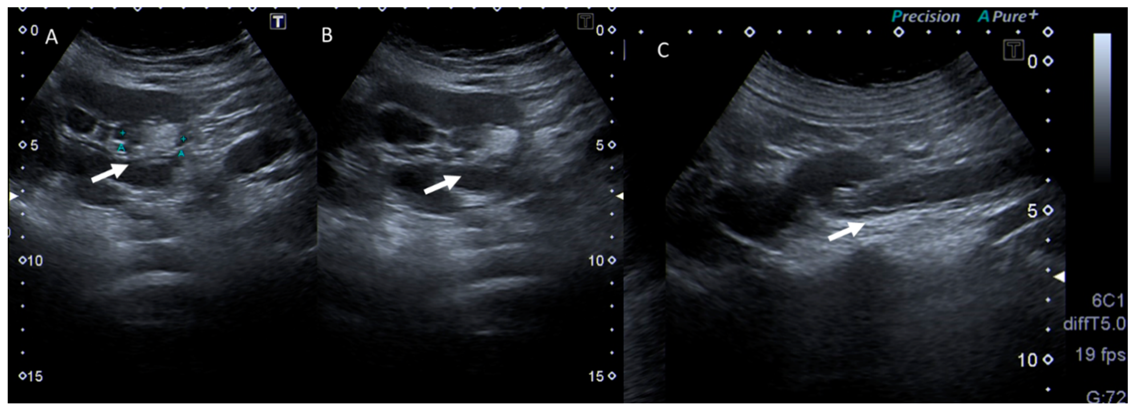 Jcm 12 01847 g004 Jcm 12 01847 g004
