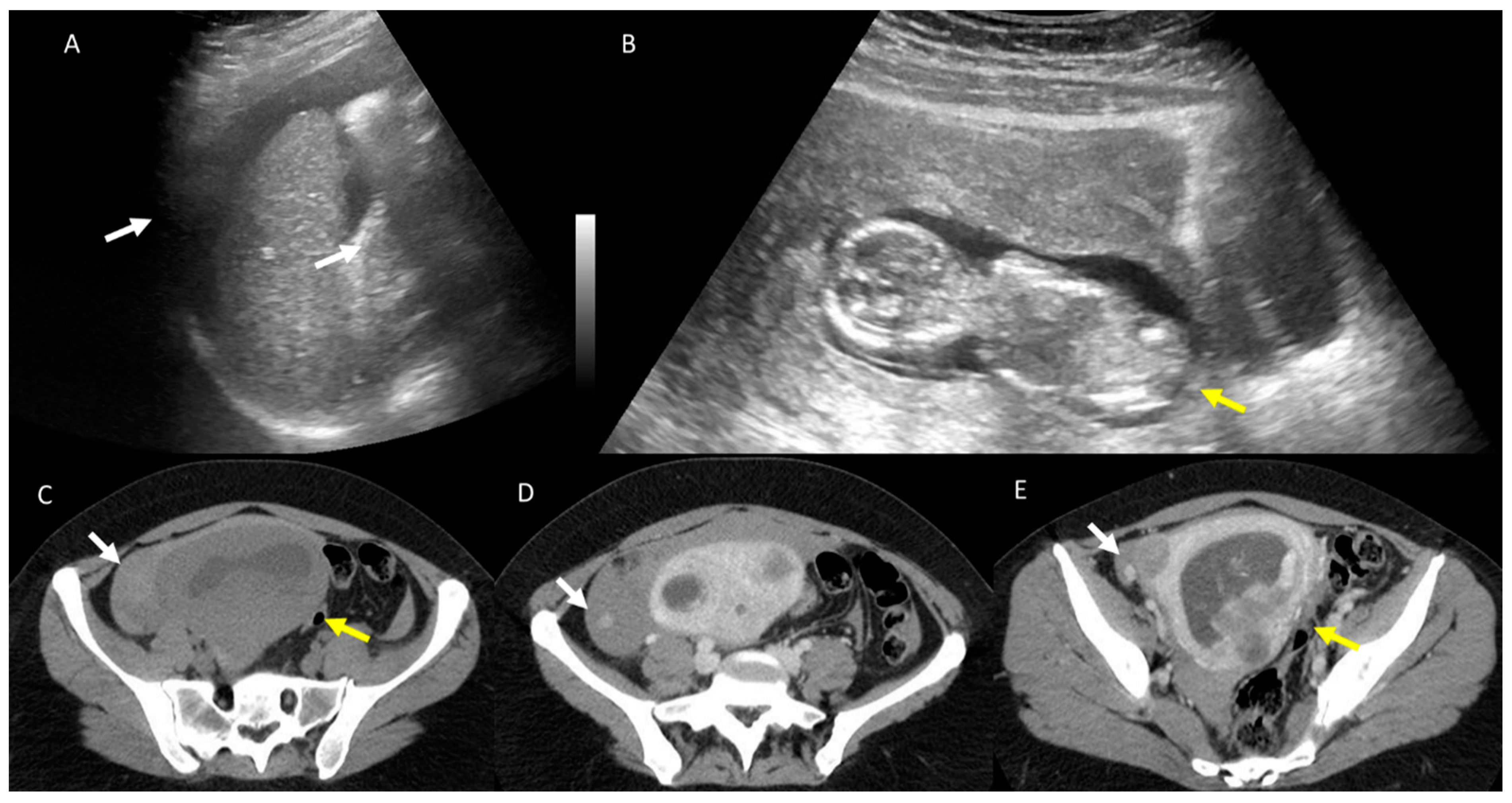 Jcm 12 01847 g006 Jcm 12 01847 g006