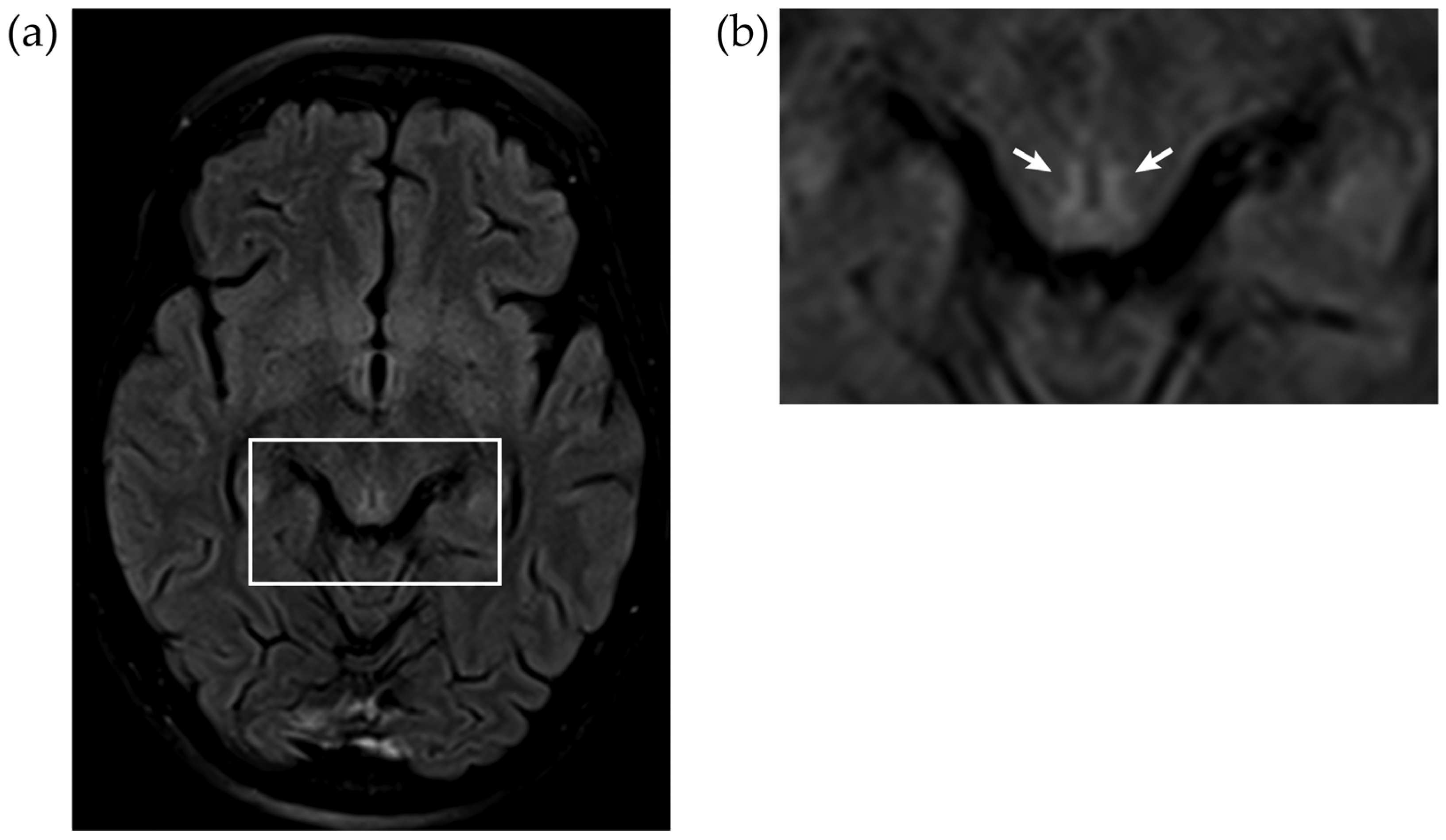 Jcm 12 02511 g002 Jcm 12 02511 g002
