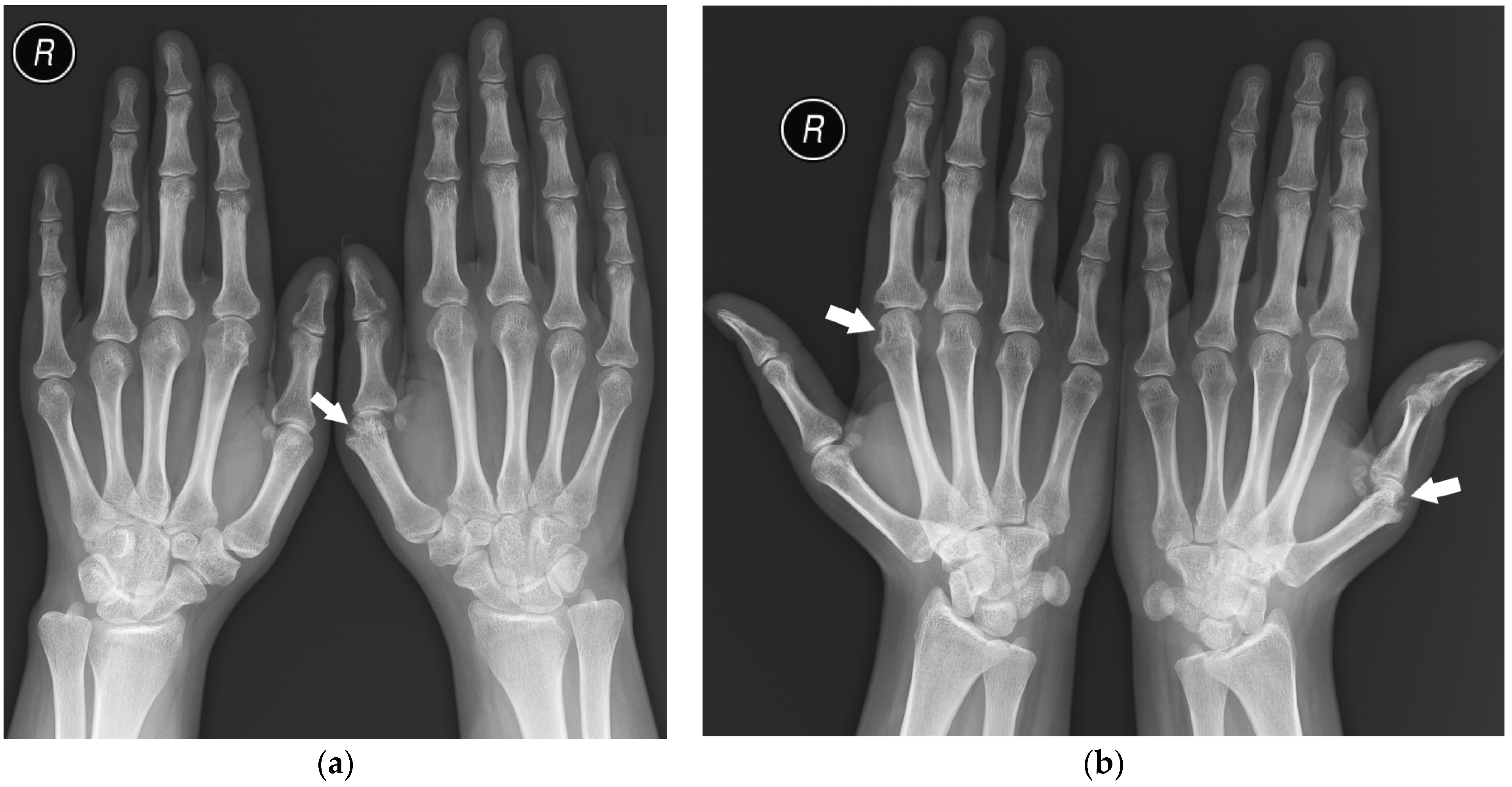 Jcm 12 02622 g007 Jcm 12 02622 g007