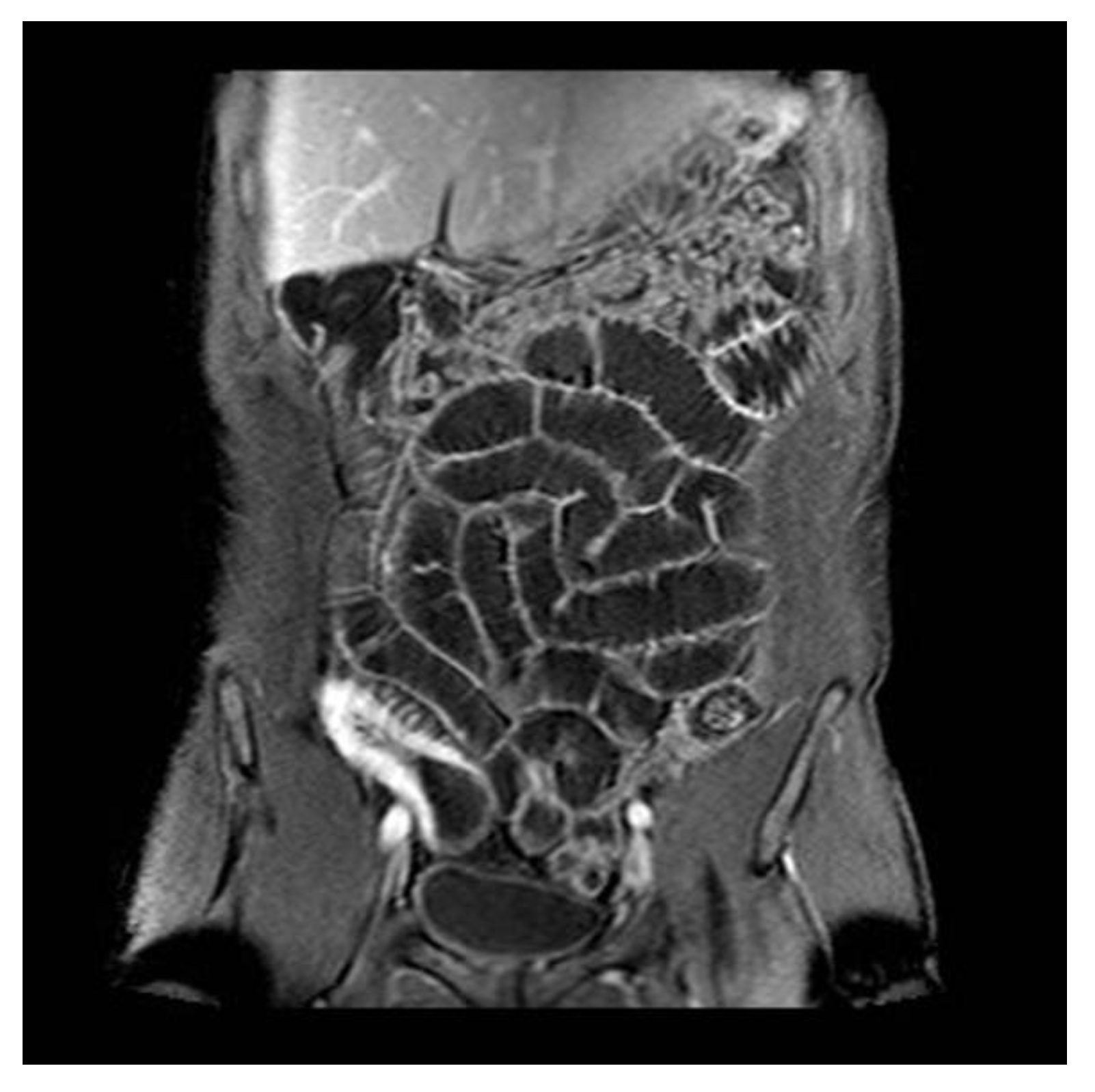 Jcm 12 02644 g0a2 Jcm 12 02644 g0a2