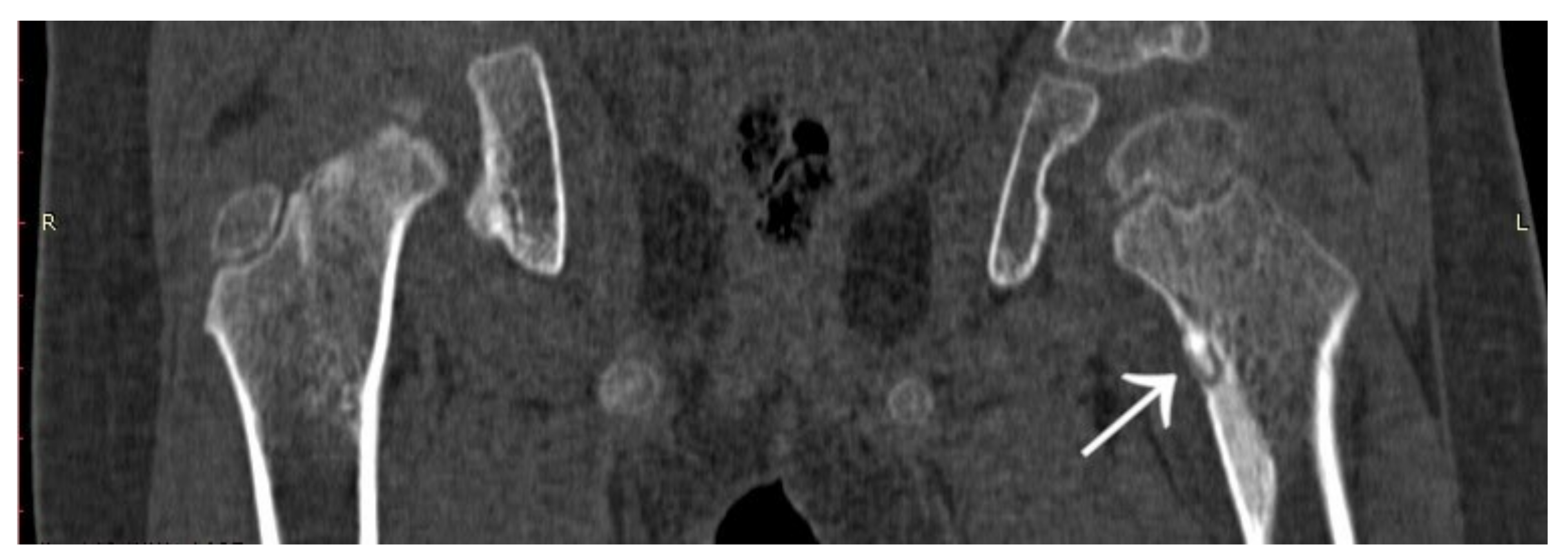 Jcm 12 02721 g007 Jcm 12 02721 g007