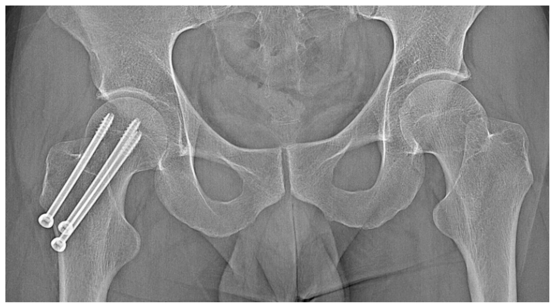 Jcm 12 02721 g009 Jcm 12 02721 g009