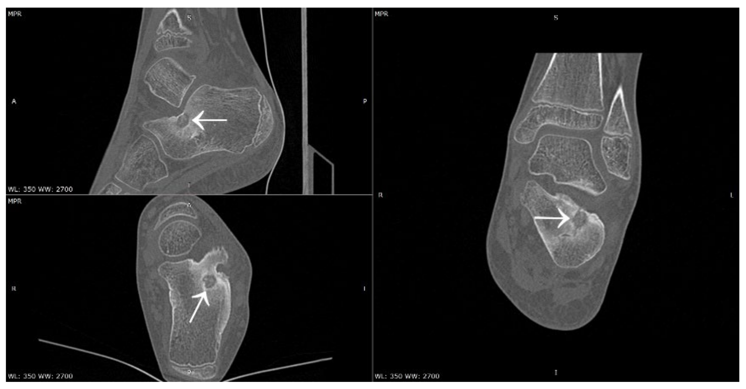 Jcm 12 02721 g017 Jcm 12 02721 g017