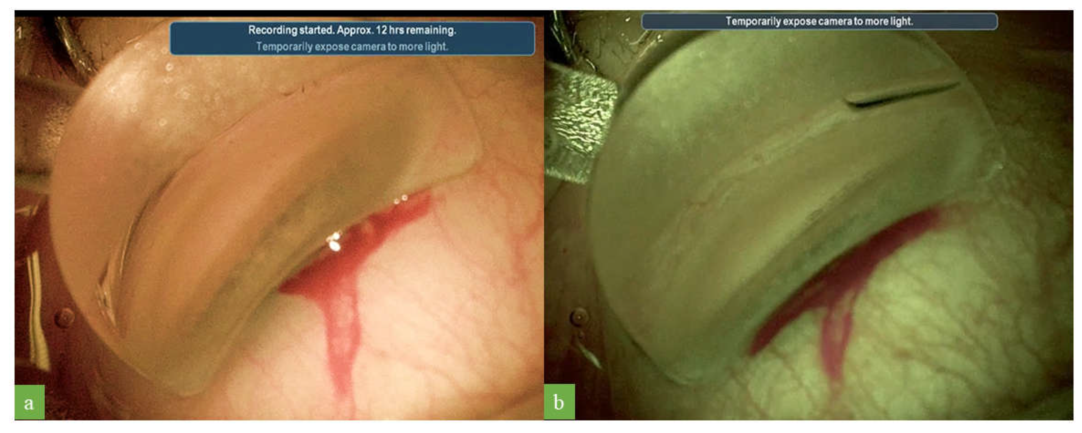 Jcm 12 02794 g003 Jcm 12 02794 g003