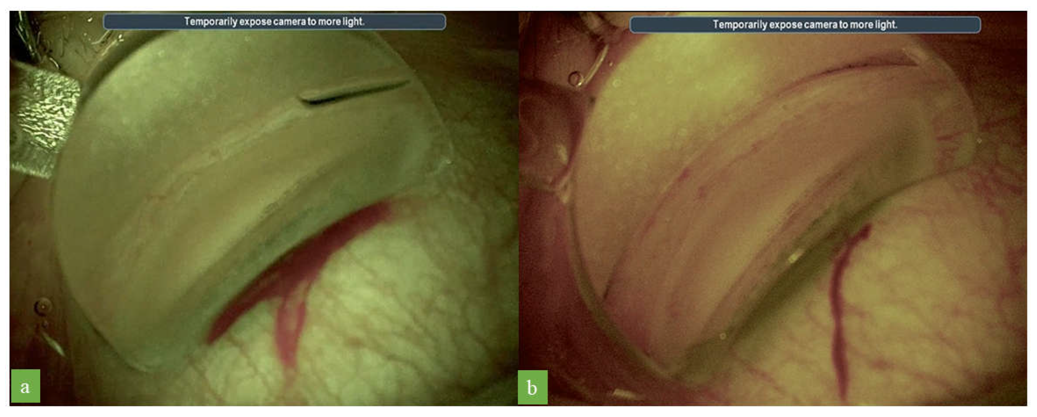 Jcm 12 02794 g004 Jcm 12 02794 g004