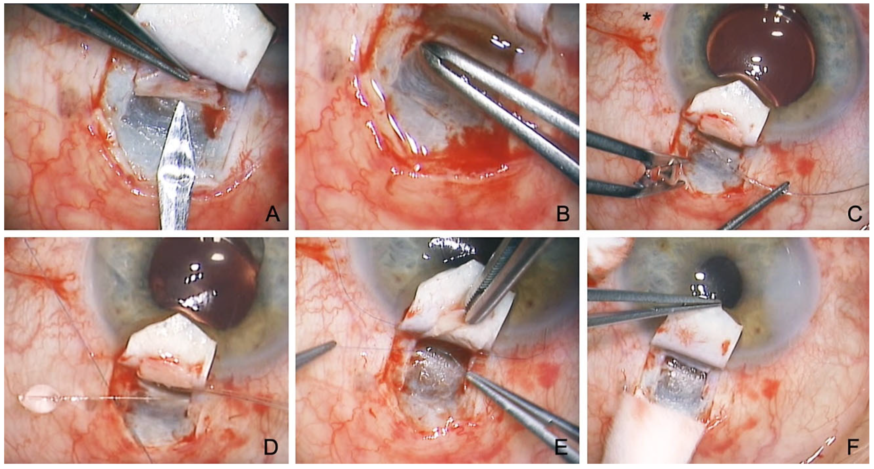 Jcm 12 03031 g002 Jcm 12 03031 g002