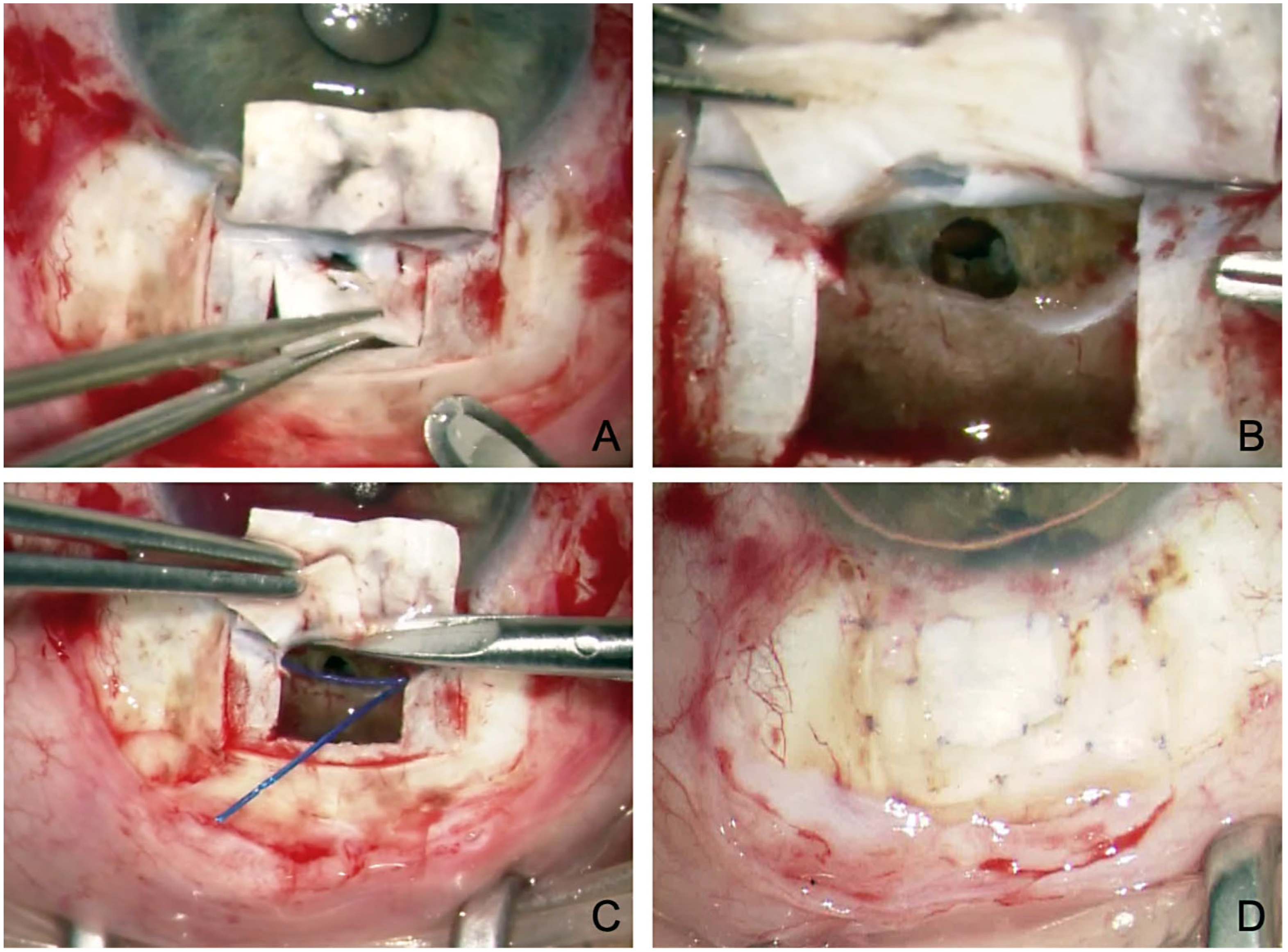 Jcm 12 03031 g003 Jcm 12 03031 g003