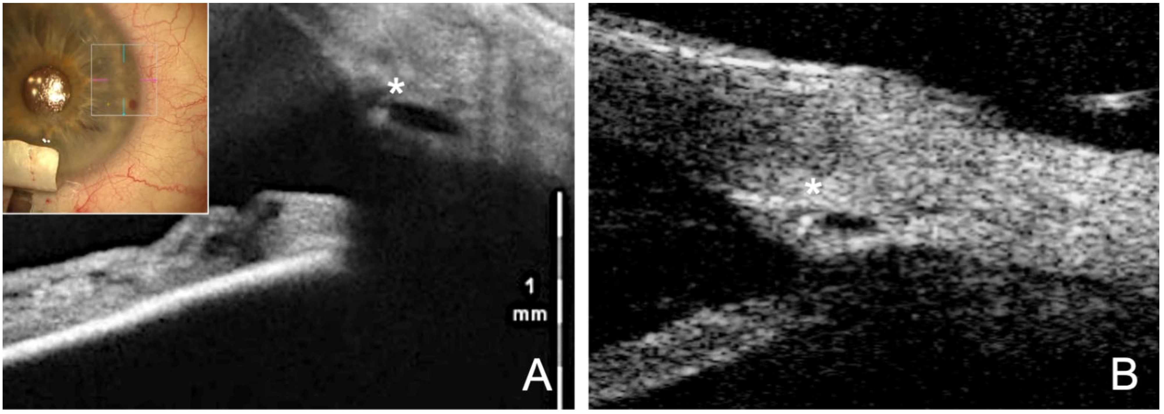 Jcm 12 03031 g004 Jcm 12 03031 g004