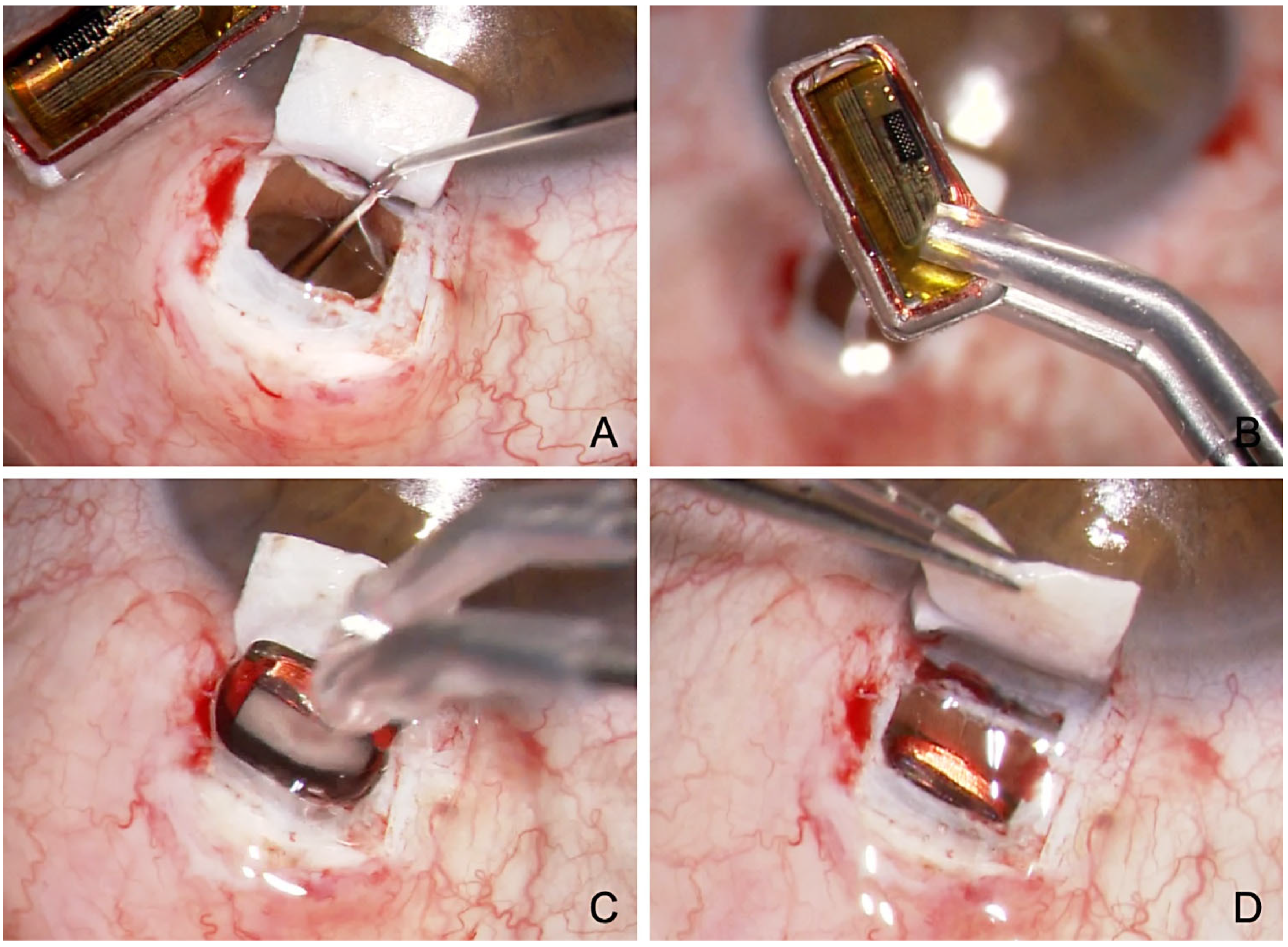 Jcm 12 03031 g007 Jcm 12 03031 g007