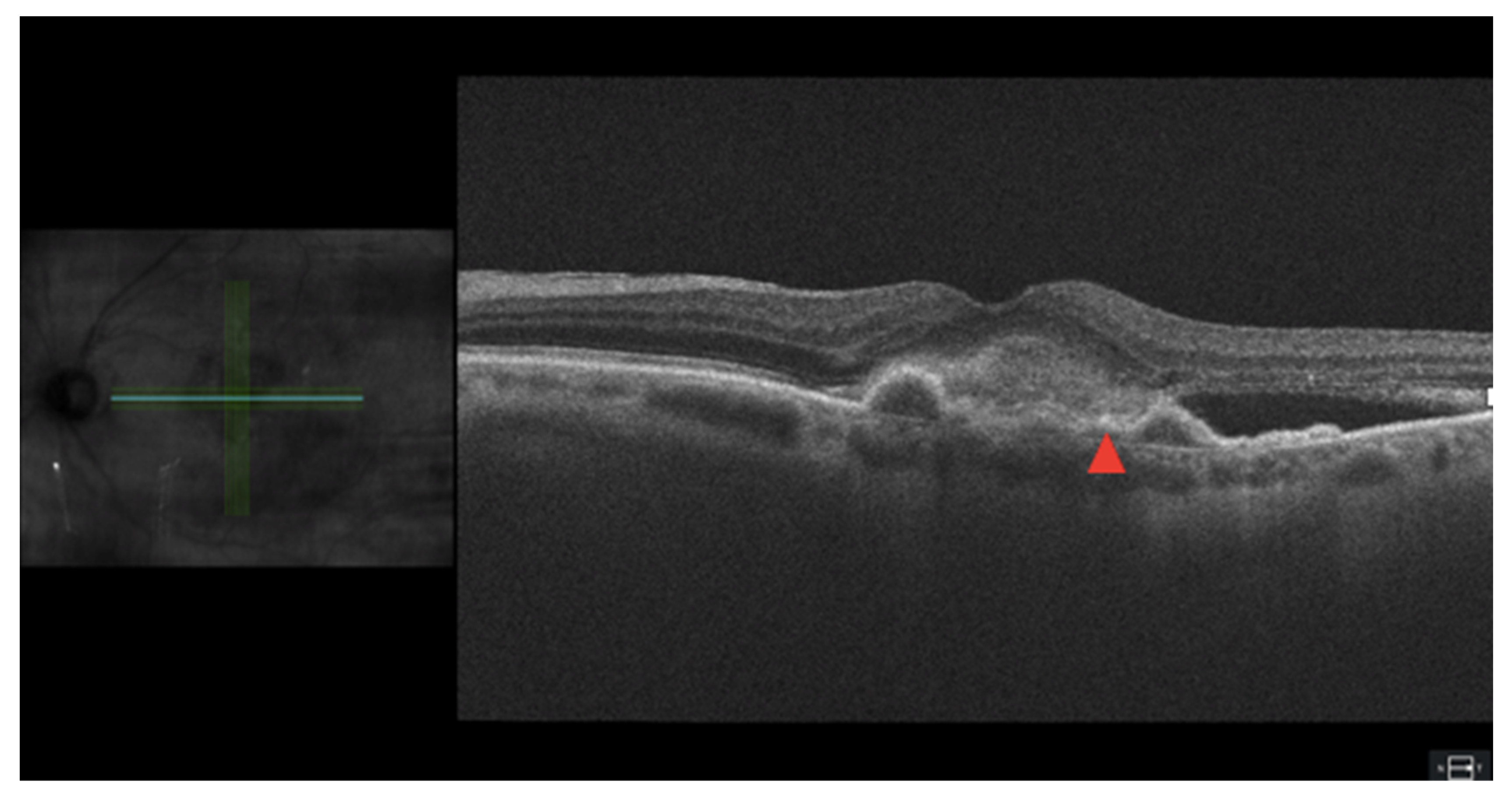 Jcm 12 03049 g003 Jcm 12 03049 g003