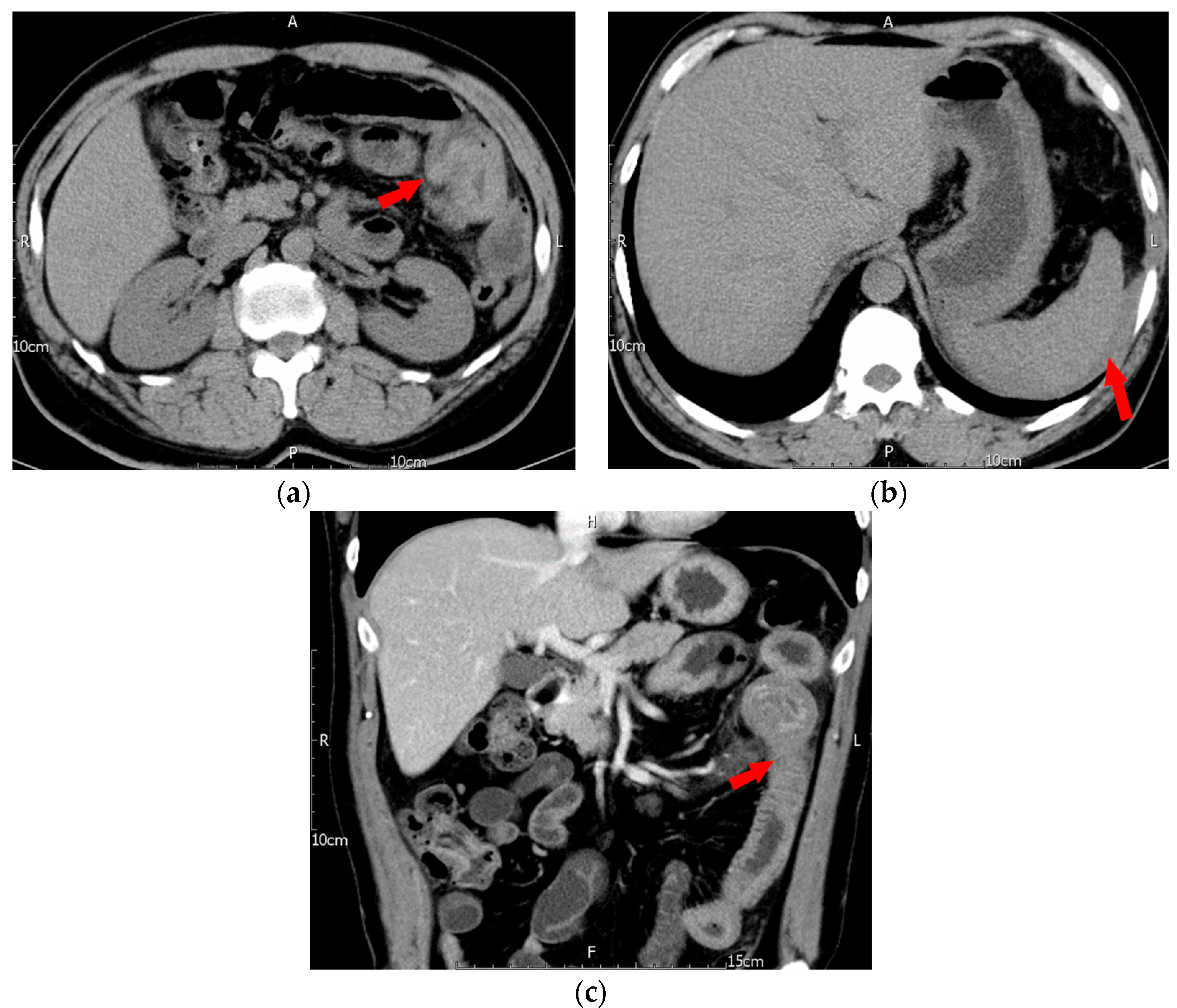Jcm 12 03093 g001 Jcm 12 03093 g001