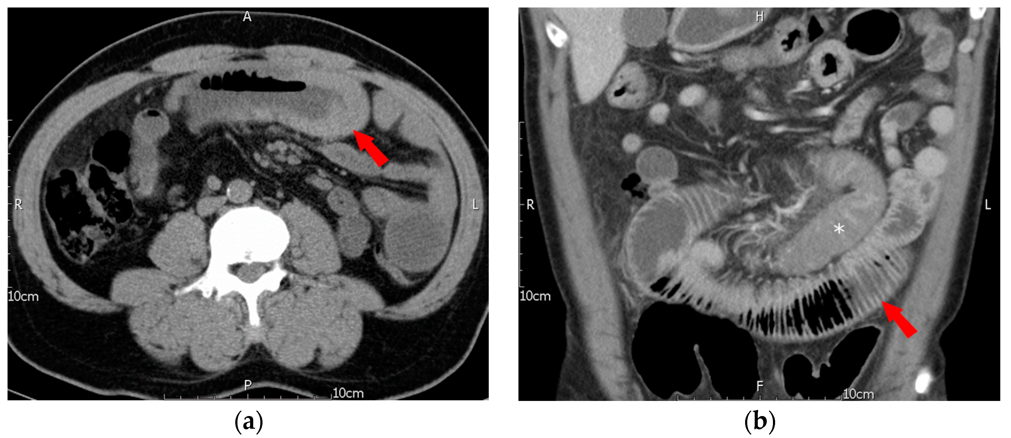 Jcm 12 03093 g002 Jcm 12 03093 g002