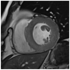 Jcm 12 03122 i005 Jcm 12 03122 i005