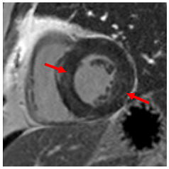 Jcm 12 03122 i007 Jcm 12 03122 i007