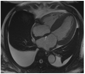 Jcm 12 03122 i009 Jcm 12 03122 i009