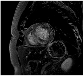 Jcm 12 03122 i011 Jcm 12 03122 i011