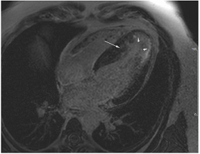 Jcm 12 03122 i014 Jcm 12 03122 i014