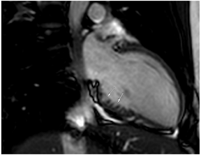 Jcm 12 03122 i015 Jcm 12 03122 i015