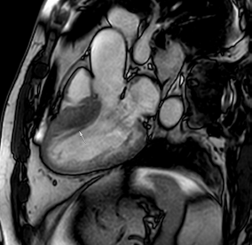 Jcm 12 03122 i016 Jcm 12 03122 i016