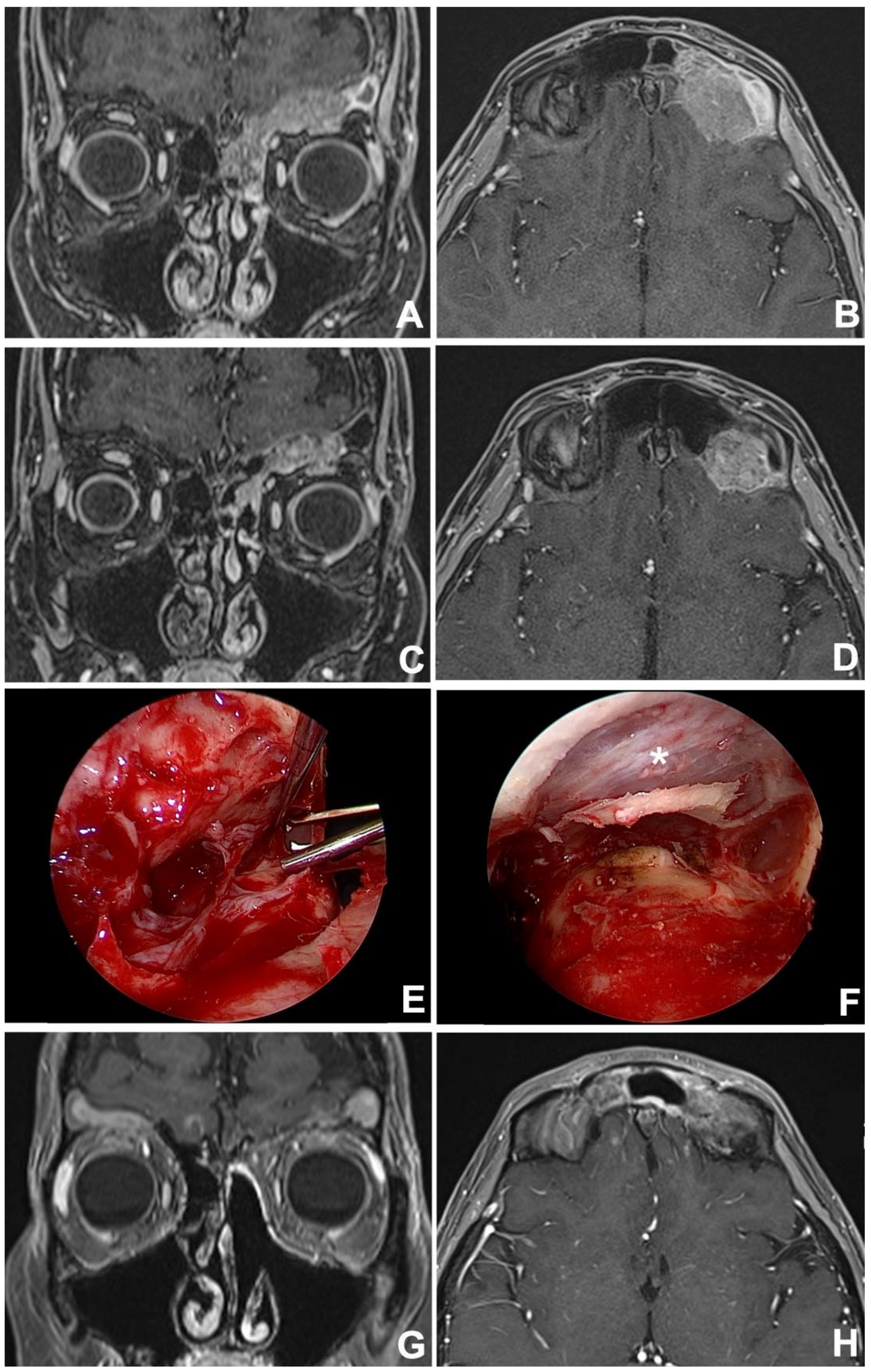 Jcm 12 03186 g003 Jcm 12 03186 g003