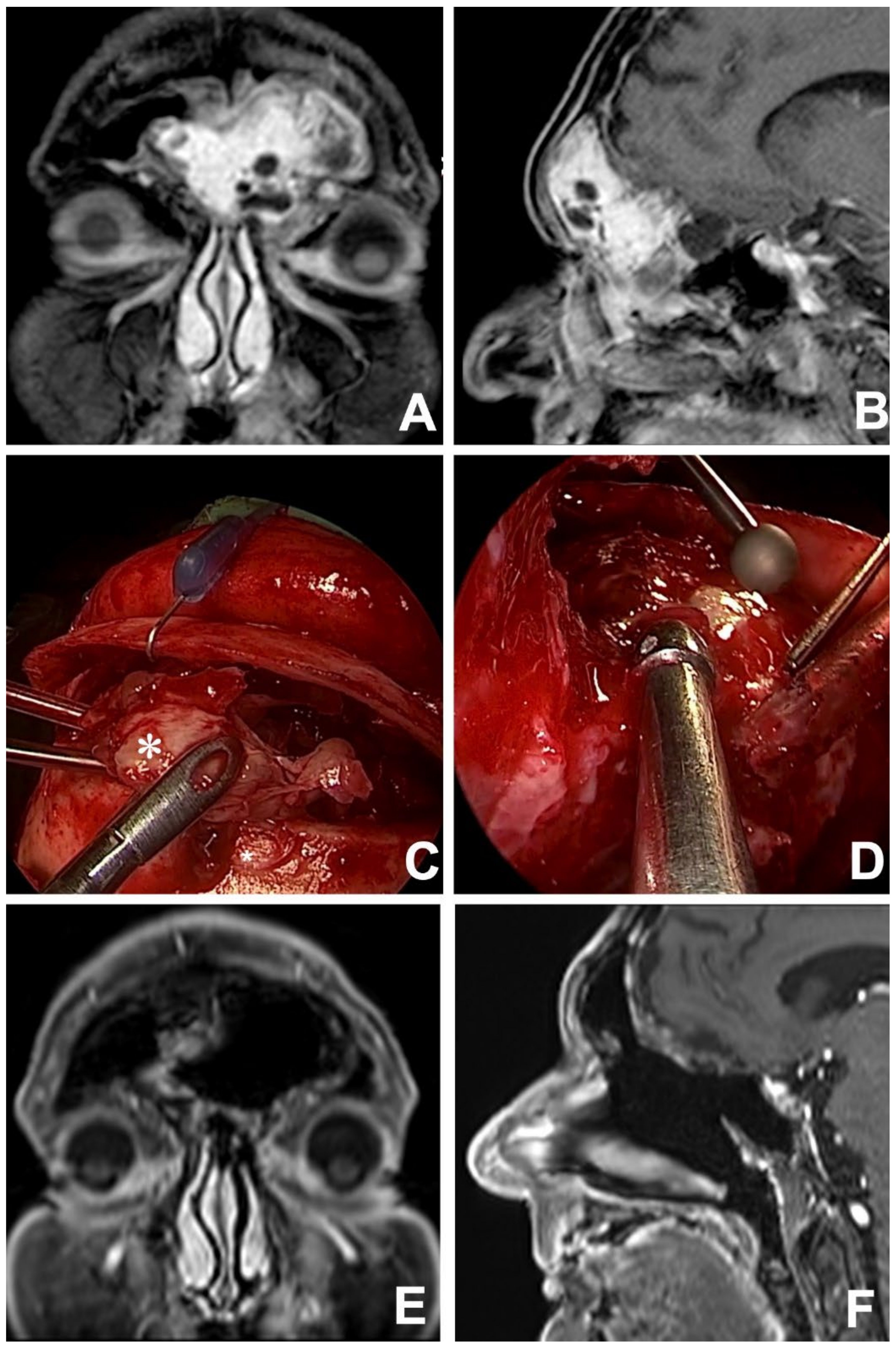 Jcm 12 03186 g005 Jcm 12 03186 g005
