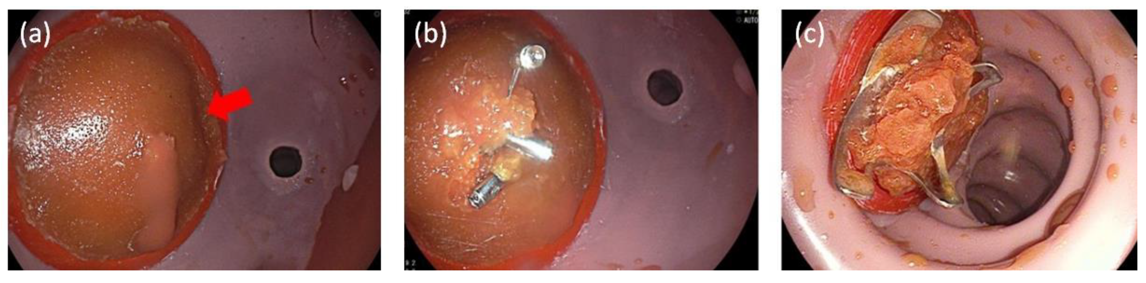 Jcm 12 03230 g003 Jcm 12 03230 g003