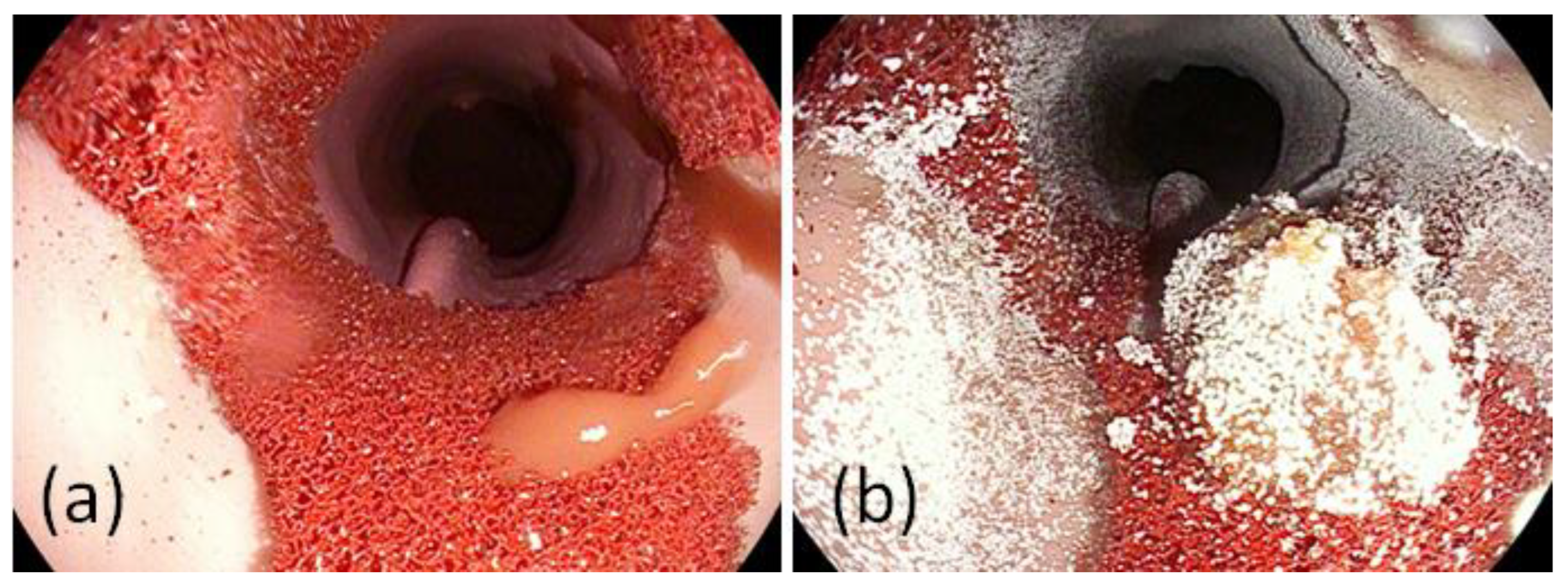 Jcm 12 03230 g005 Jcm 12 03230 g005