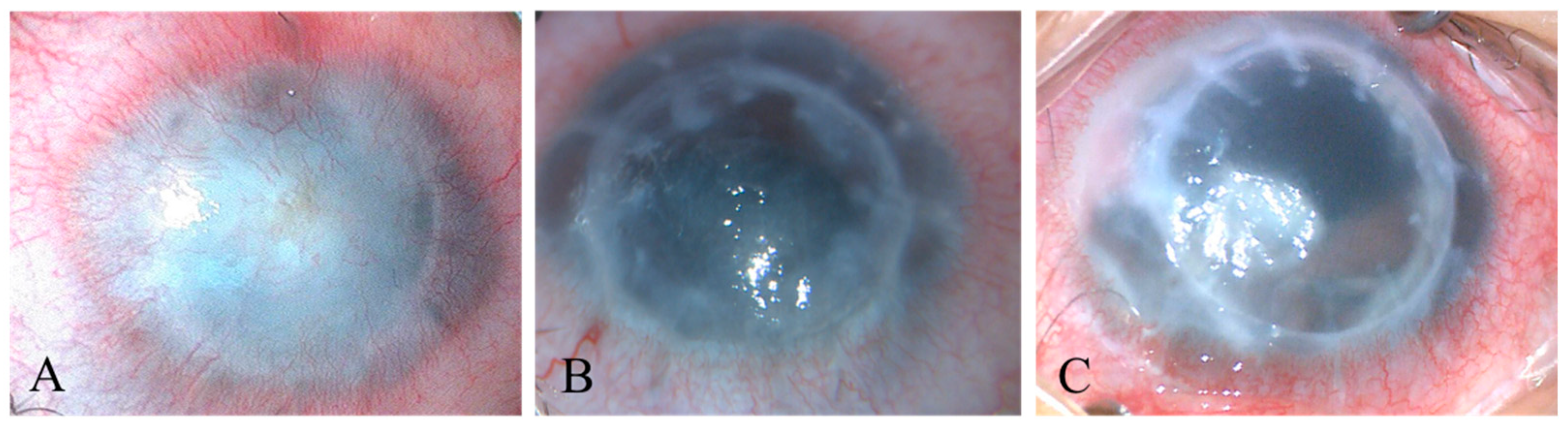 Jcm 12 03346 g001 Jcm 12 03346 g001