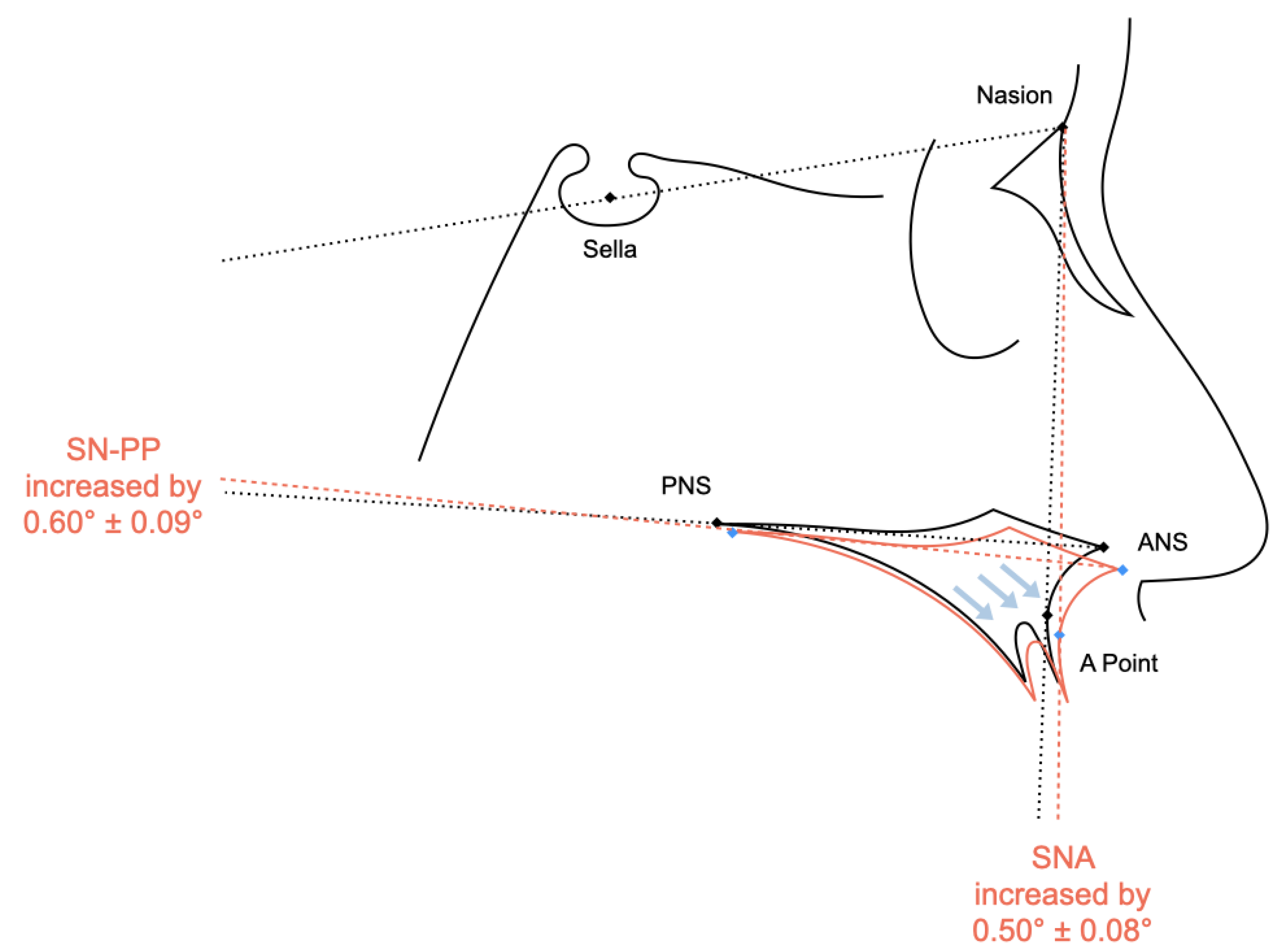 Jcm 12 03488 g004 Jcm 12 03488 g004