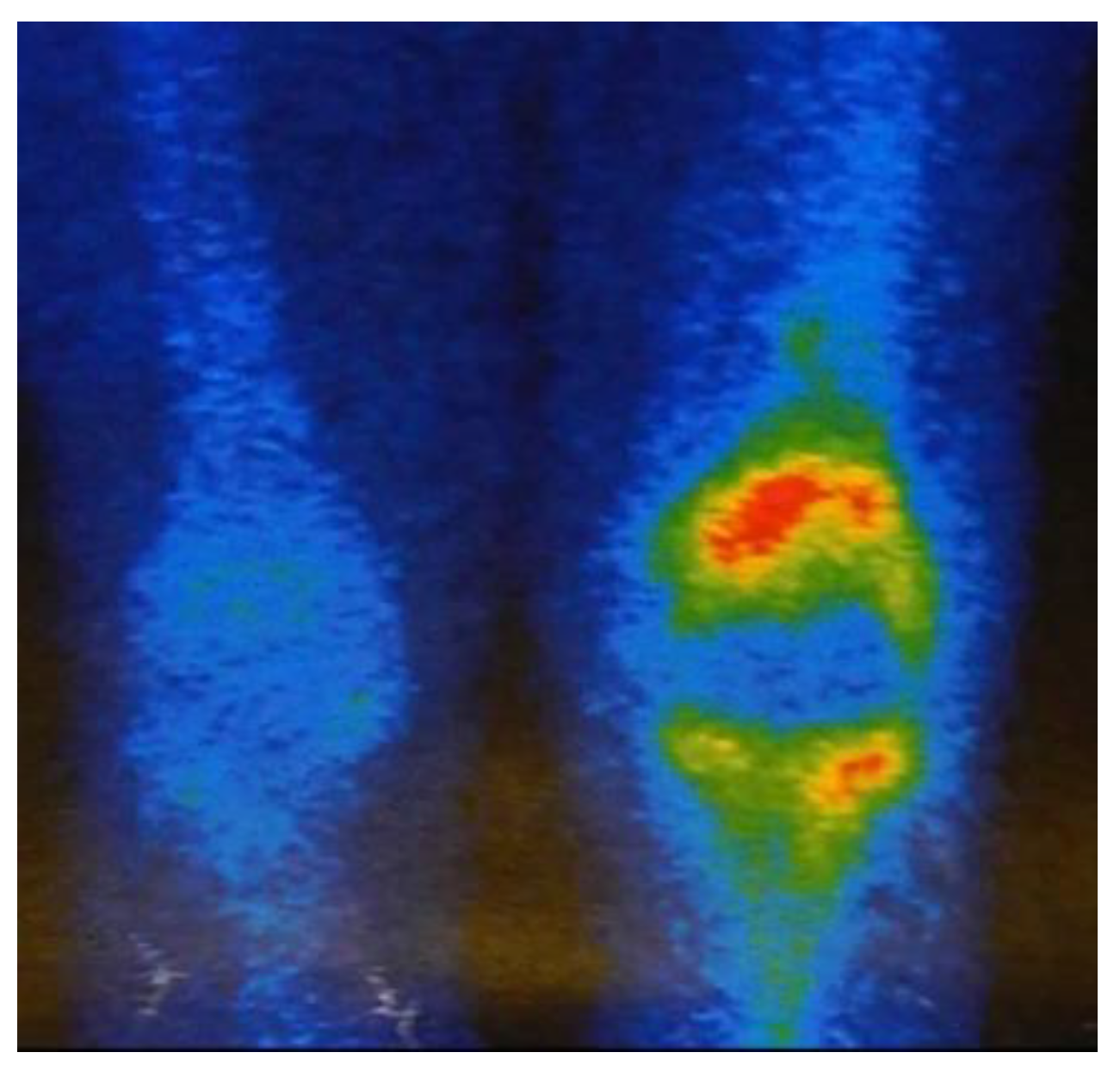 Jcm 12 03600 g003 Jcm 12 03600 g003